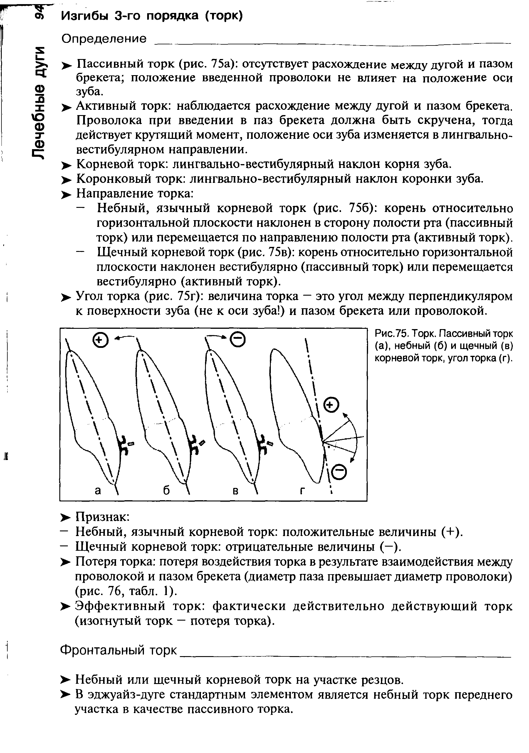 Рис.75. Торк. Пассивный торк (а), небный (б) и щечный (в) корневой торк, угол торка (г).