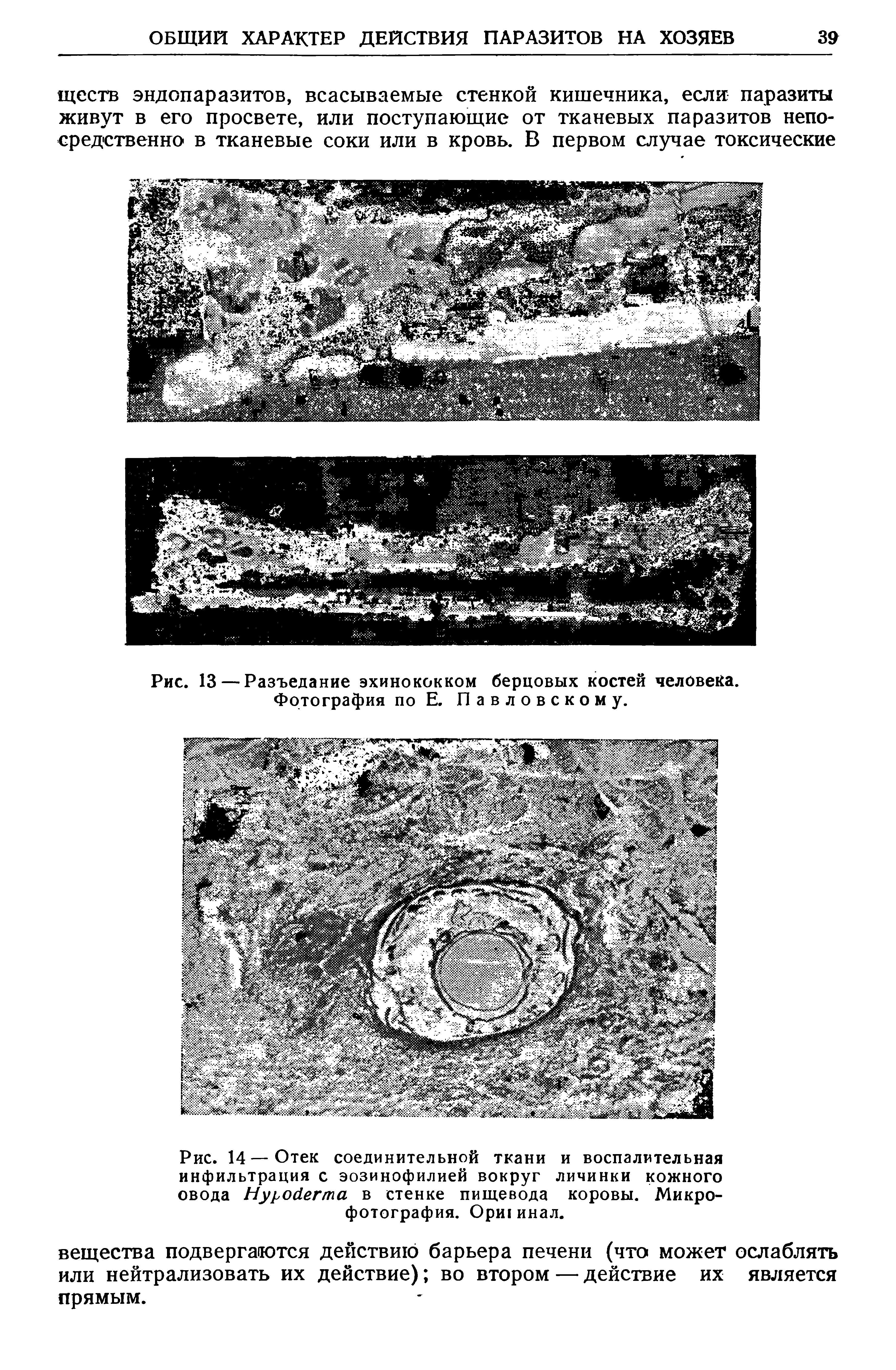 Рис. 14—Отек соединительной ткани и воспалительная инфильтрация с эозинофилией вокруг личинки кожного овода Нуройегта в стенке пищевода коровы. Микрофотография. Ори1инал.