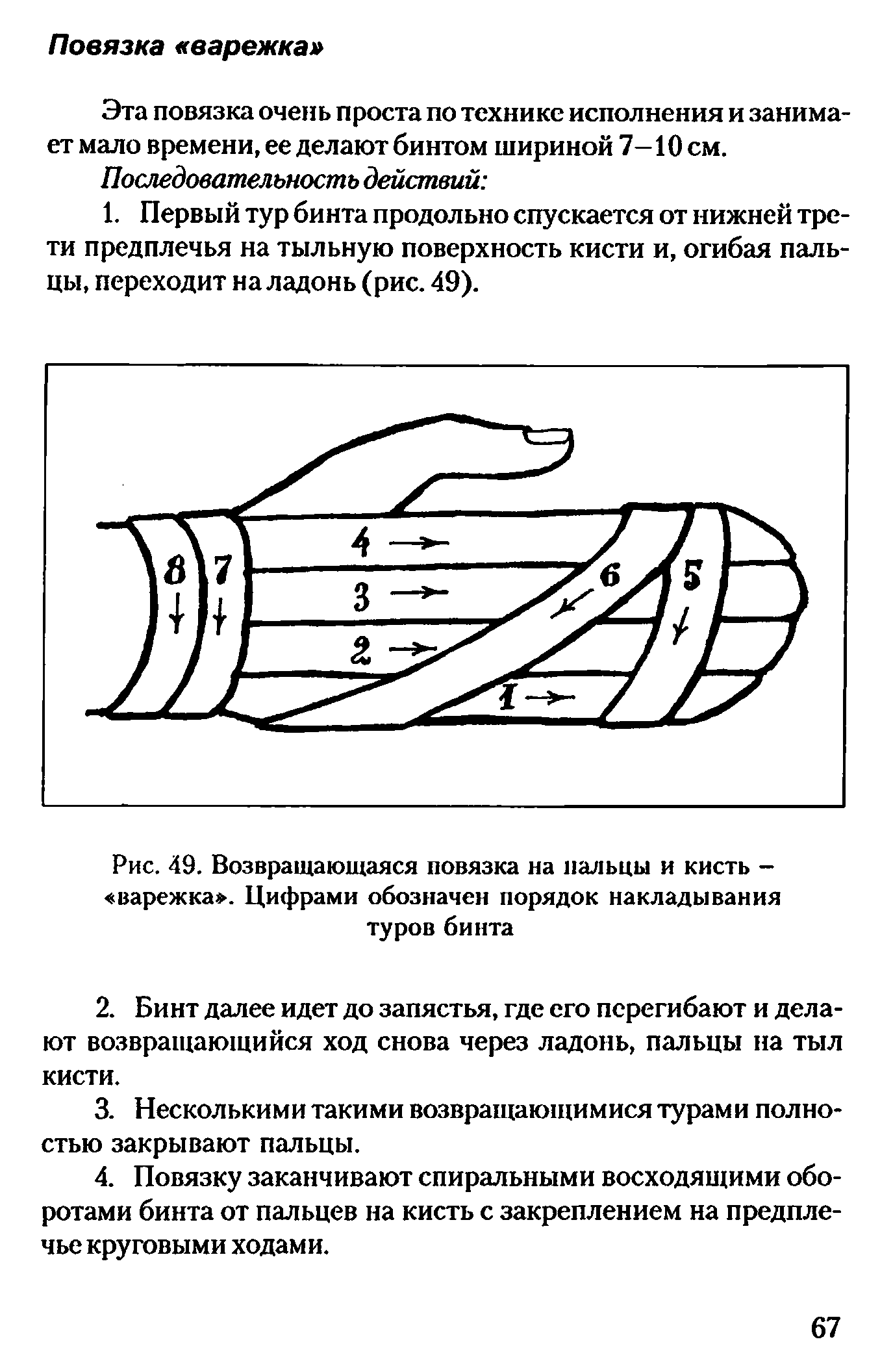 Рис. 49. Возвращающаяся повязка на пальцы и кисть - варежка . Цифрами обозначен порядок накладывания туров бинта...