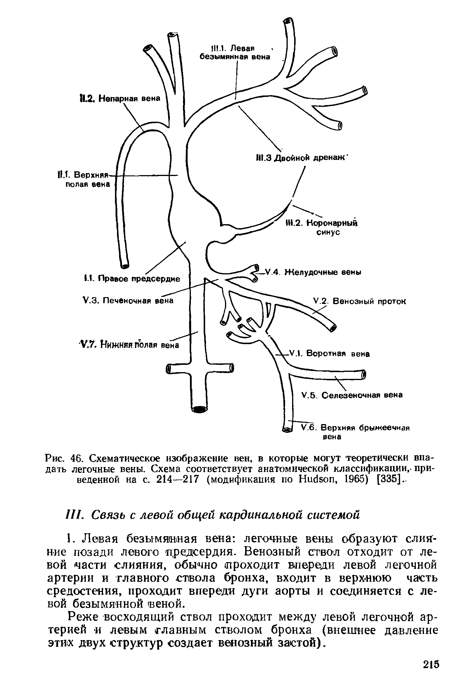 Рис. 46. Схематическое изображение вен, в которые могут теоретически впадать легочные вены. Схема соответствует анатомической классификации,- приведенной на с. 214—217 (модификация по H , 1965) [335]..