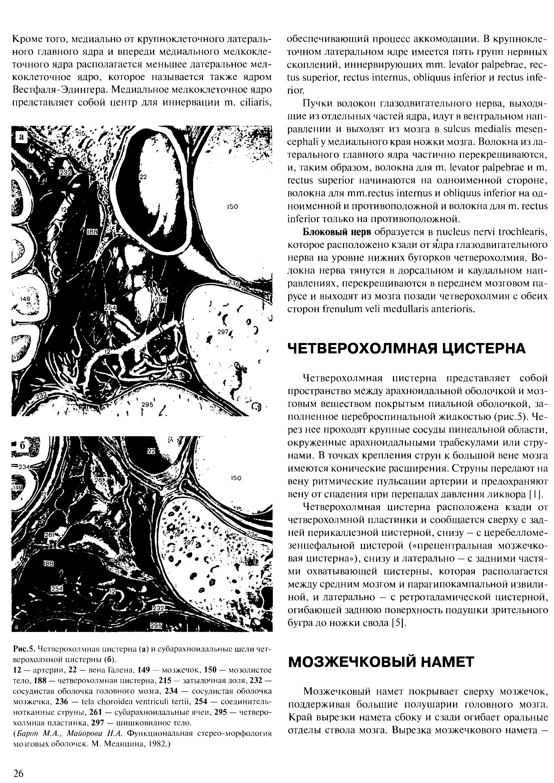 Рис.5. Четверохолмная цистерна (а) и субарахноидальные щели четверохолмной цистерны (б).