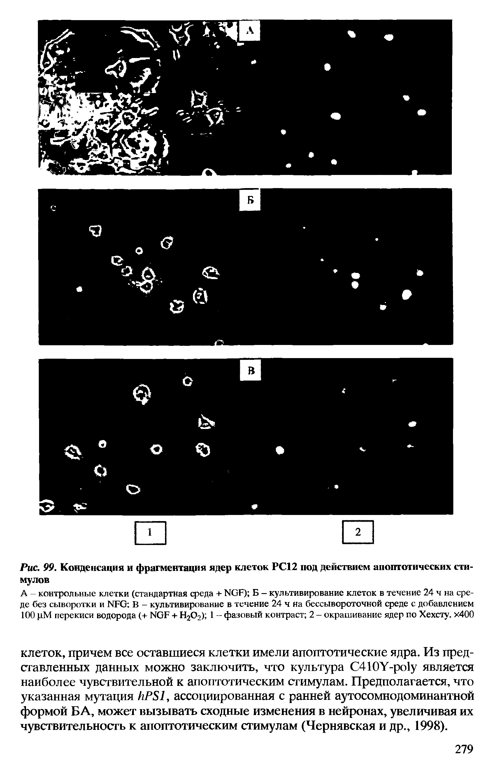 Рис. 99. Конденсация и фрагментация ядер клеток РС12 под действием апоптотических стимулов...