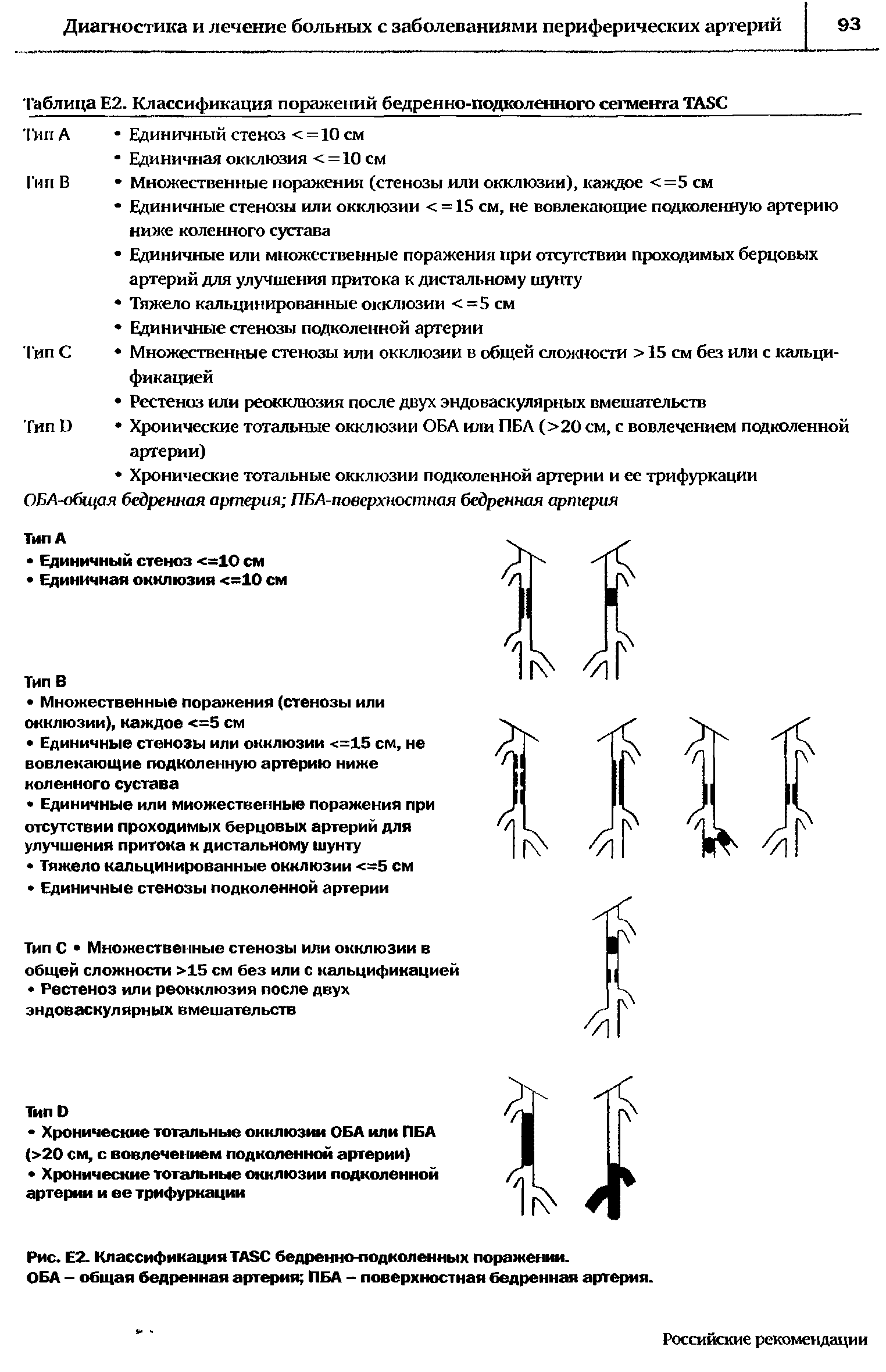 Рис. Е2. Классификация ТА8С бедренно-подколенных поражении. ОБА - общая бедренная артерия ПБА - поверхностная бедренная артерия.