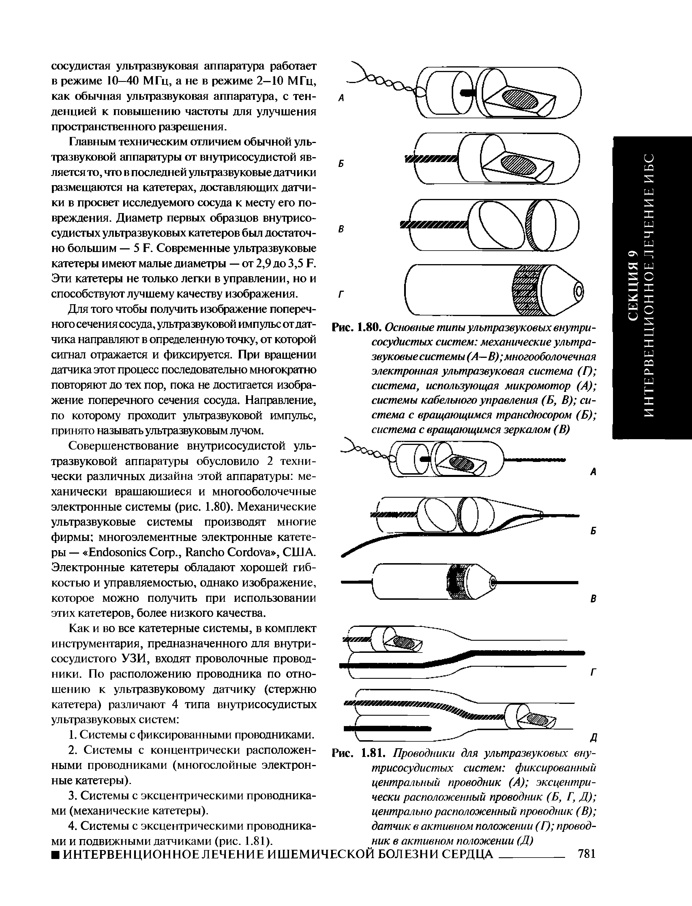 Рис. 1.80. Основные типы ультразвуковых внутрисосудистых систем механические ультразвуковые системы (А—В) многооболочечная электронная ультразвуковая система (Г) система, использующая микромотор (А) системы кабельного управления (Б, В) система с вращающимся трансдюсором (Б) система с вращающимся зеркалом (В)...