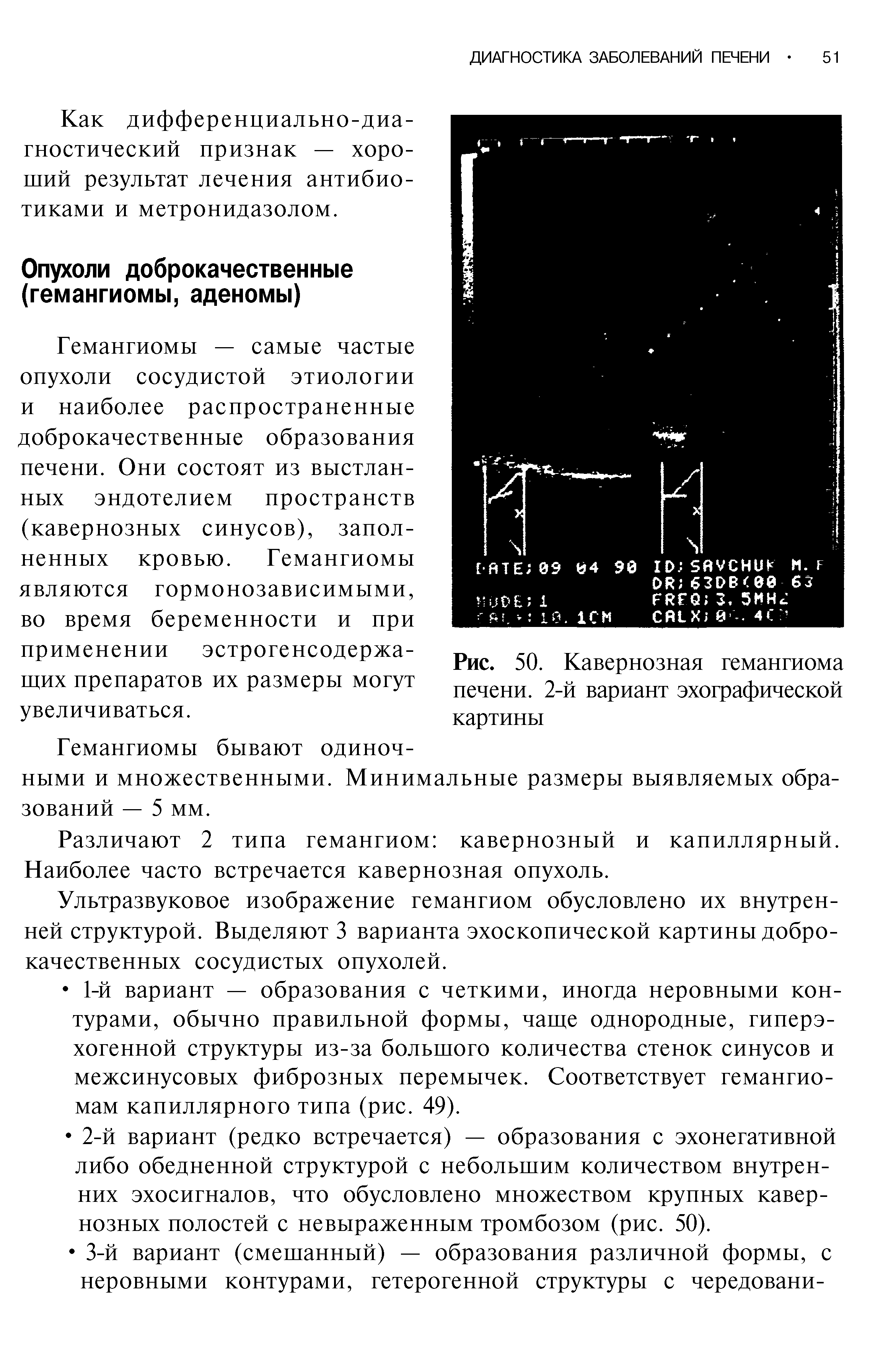 Рис. 50. Кавернозная гемангиома печени. 2-й вариант эхографической картины...