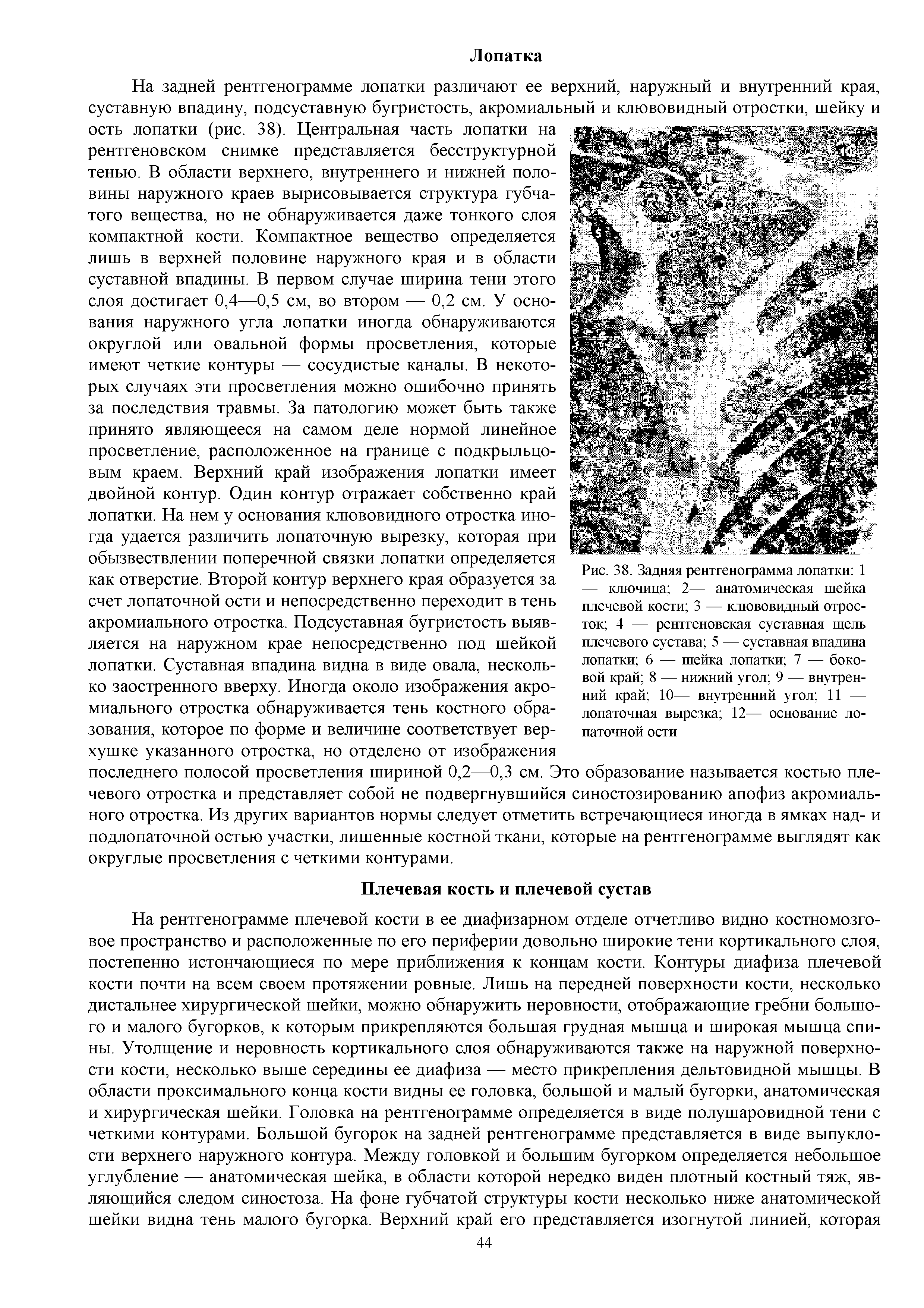 Рис. 38. Задняя рентгенограмма лопатки 1 — ключица 2— анатомическая шейка плечевой кости 3 — клювовидный отросток 4 — рентгеновская суставная щель плечевого сустава 5 — суставная впадина лопатки 6 — шейка лопатки 7 — боковой край 8 — нижний угол 9 — внутренний край 10— внутренний угол 11 — лопаточная вырезка 12— основание лопаточной ости...