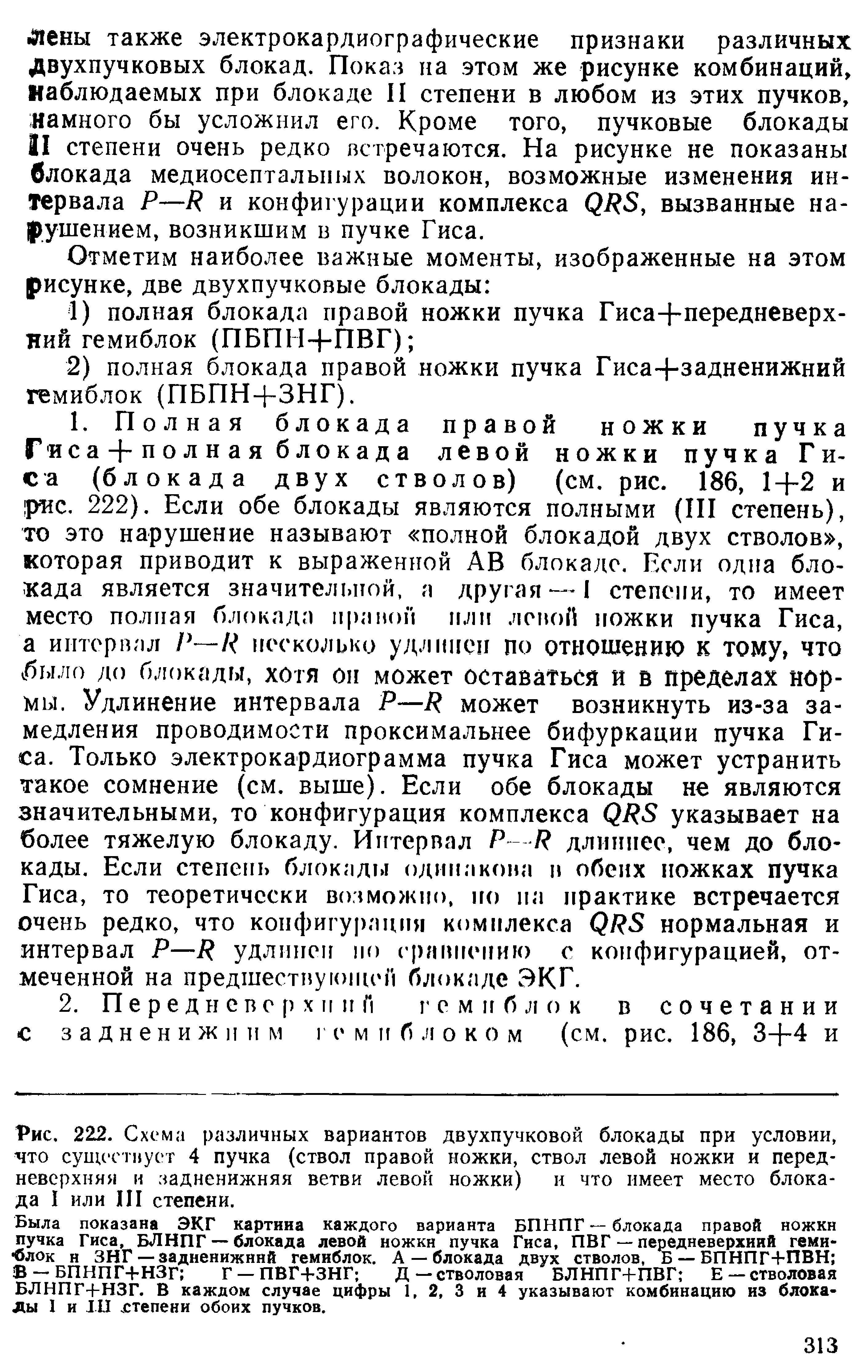 Рис. 222. Схема различных вариантов двухпучковой блокады при условии, что существует 4 пучка (ствол правой ножки, ствол левой ножки и передневерхняя и задненижняя ветви левой ножки) и что имеет место блокада I или III степени.