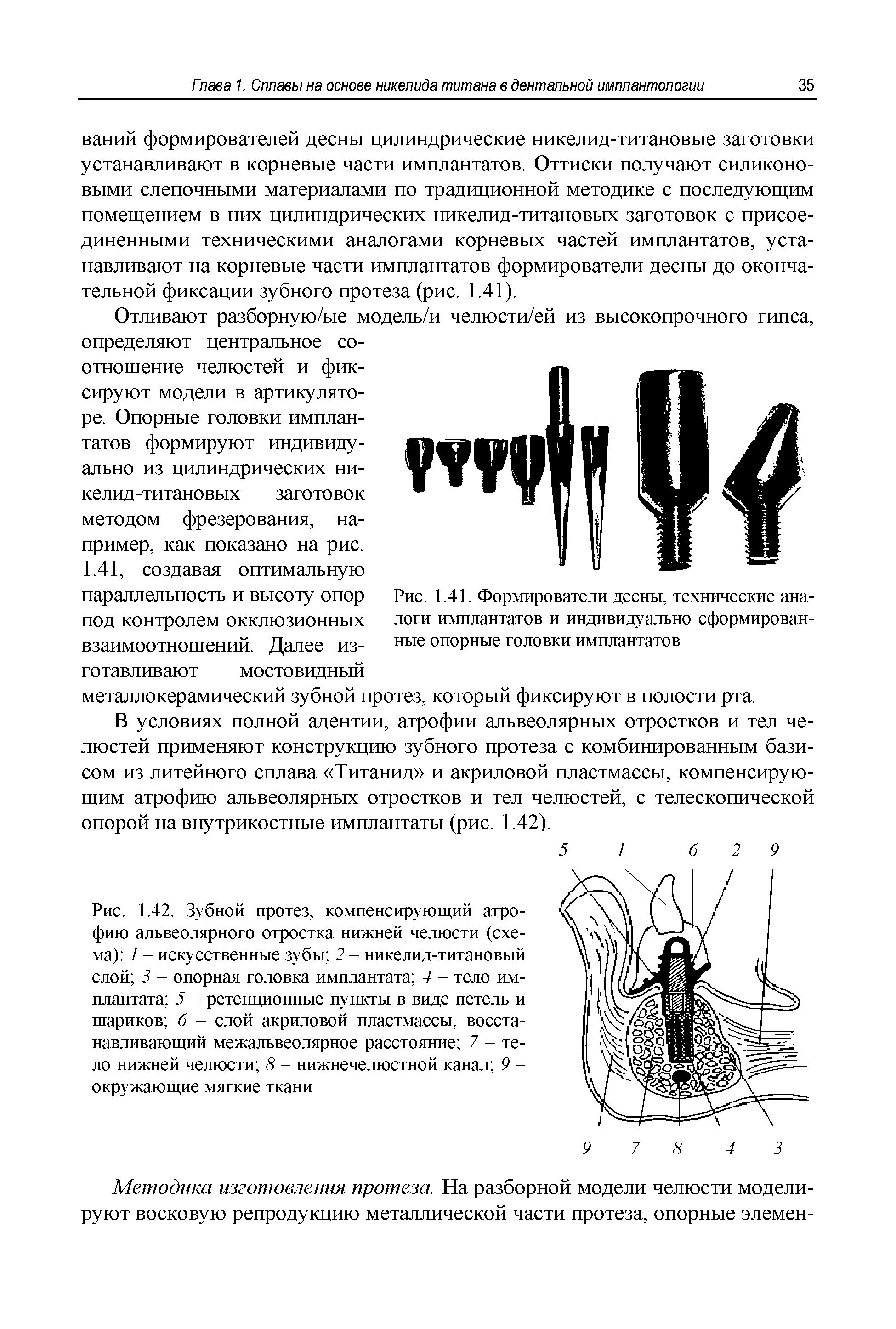 Рис. 1.41. Формирователи десны, технические аналоги имплантатов и индивидуально сформированные опорные головки имплантатов...