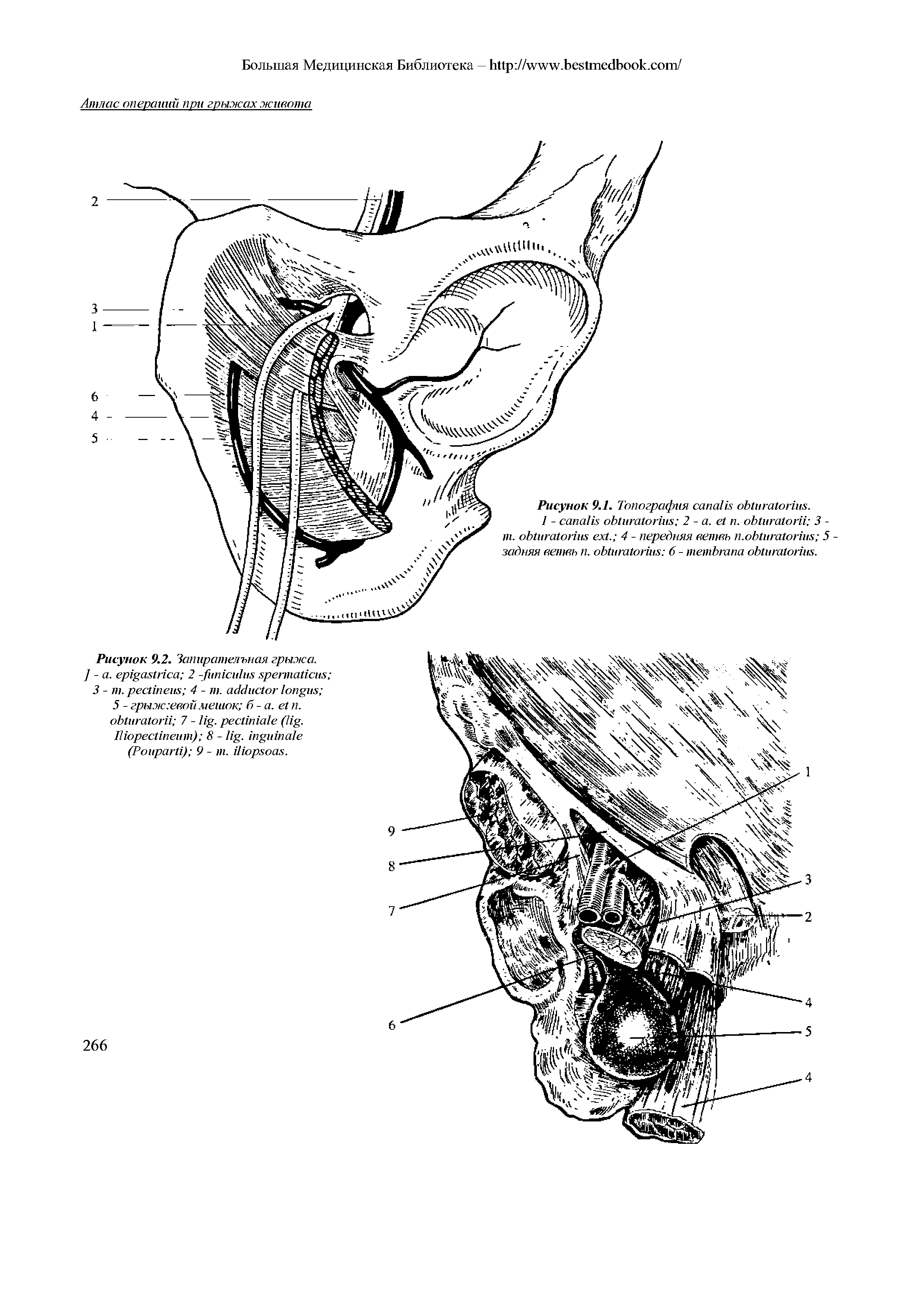 Рисунок 9.2. Запирательная грыжа. ] - . 2 - ...