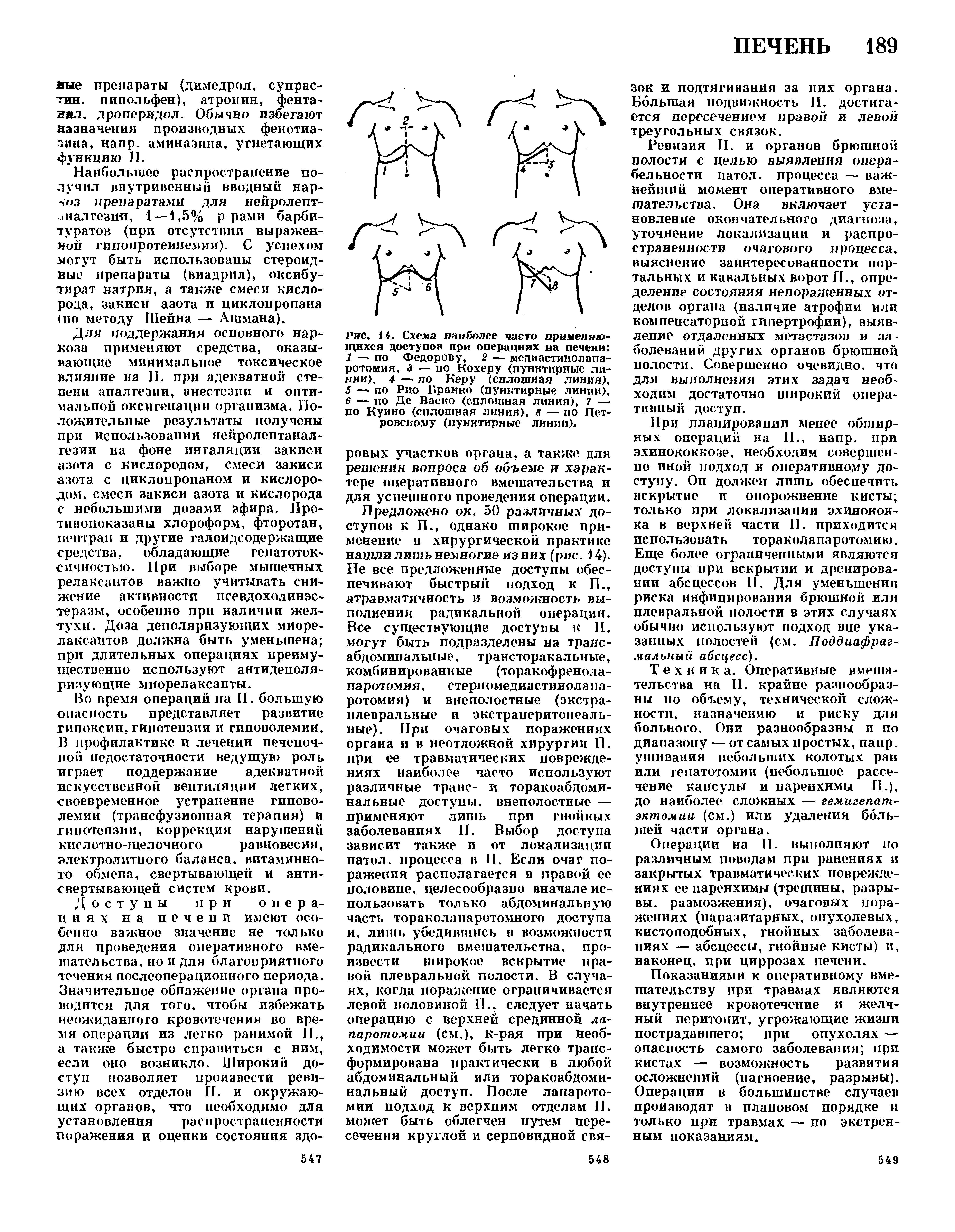 Рис. 14. Схема наиболее часто применяющихся доступов при операциях на печени 1 — по Федорову, 2 — мсдиастинолапа-ротомия, 3 — по Кохеру (пунктирные линии), 4 — по Керу (сплошная линия),...