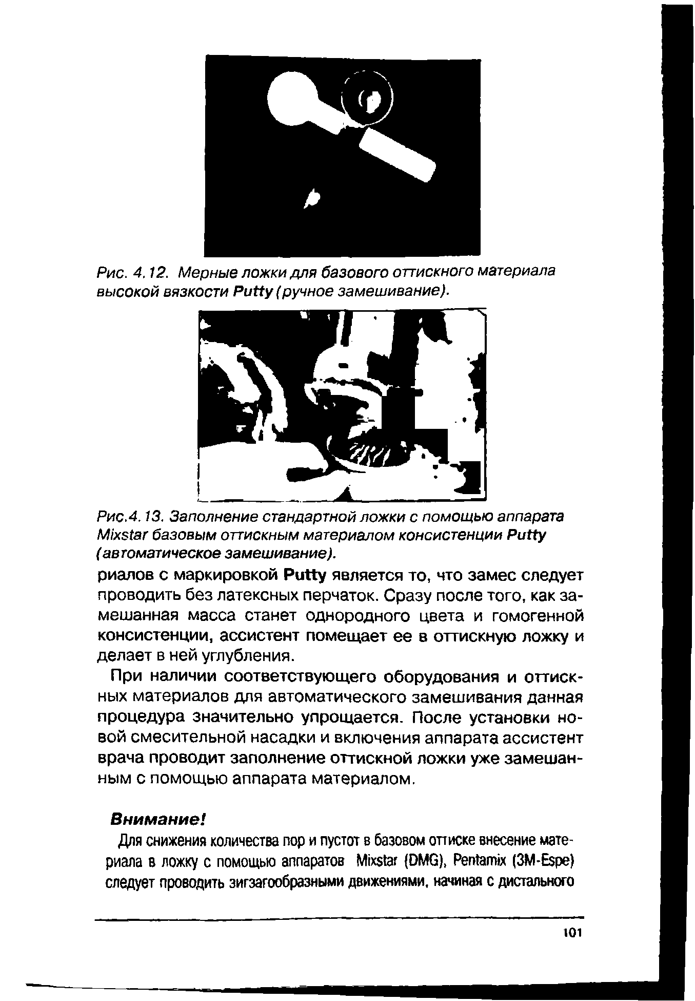 Рис.4.13. Заполнение стандартной ложки с помощью аппарата M базовым оттискным материалом консистенции P (автоматическое замешивание).