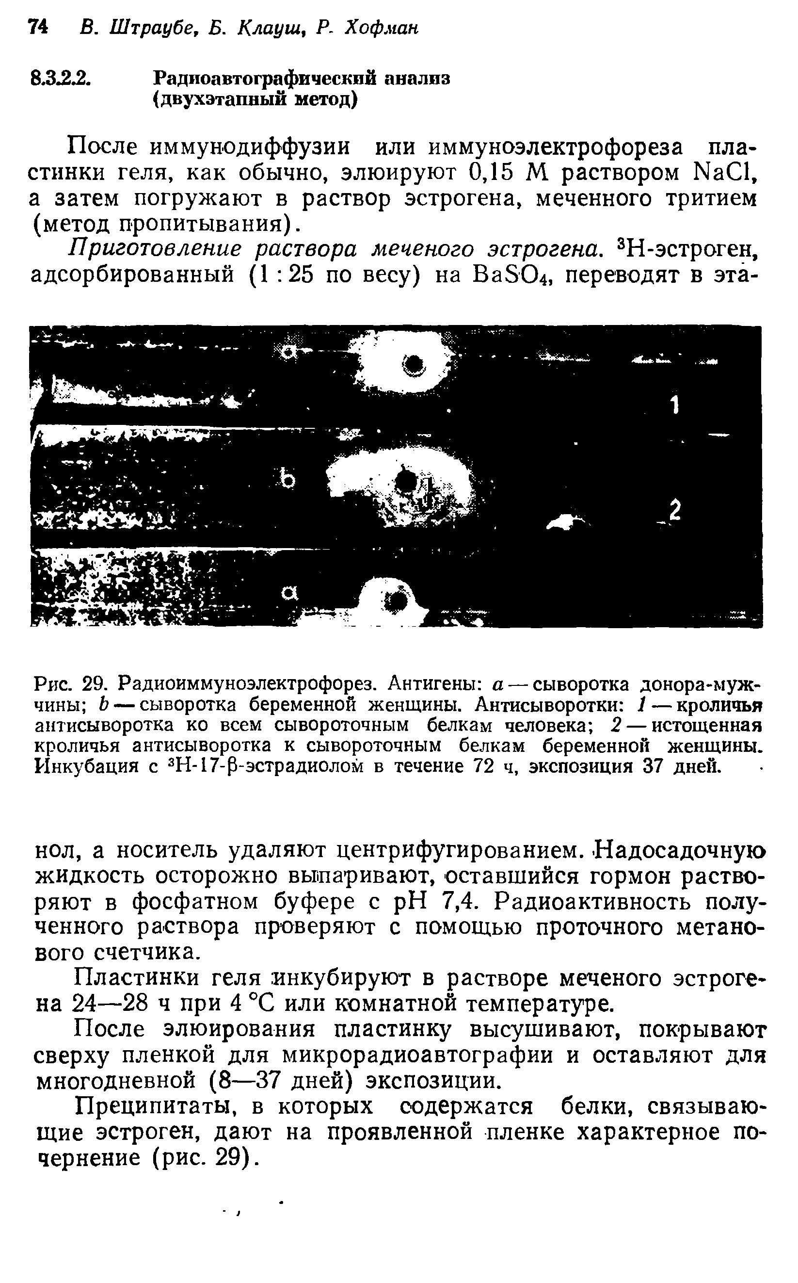 Рис. 29. Радиоиммуноэлектрофорез. Антигены а — сыворотка донора-мужчины Ь — сыворотка беременной женщины. Антисыворотки 1 — кроличья антисыворотка ко всем сывороточным белкам человека 2 — истощенная кроличья антисыворотка к сывороточным белкам беременной женщины. Инкубация с 3Н-17-Р-эстрадиолом в течение 72 ч, экспозиция 37 дней.