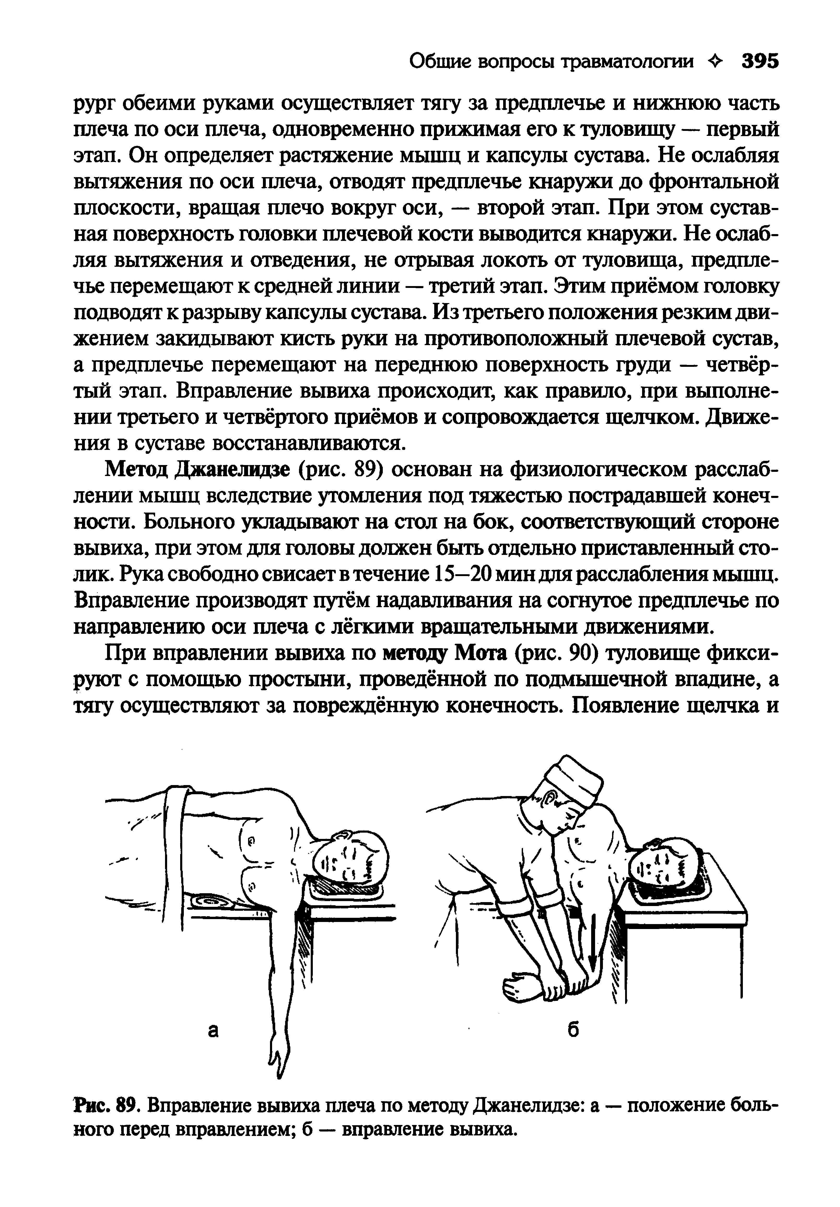 Рис. 89. Вправление вывиха плеча по методу Джанелидзе а — положение больного перед вправлением б — вправление вывиха.