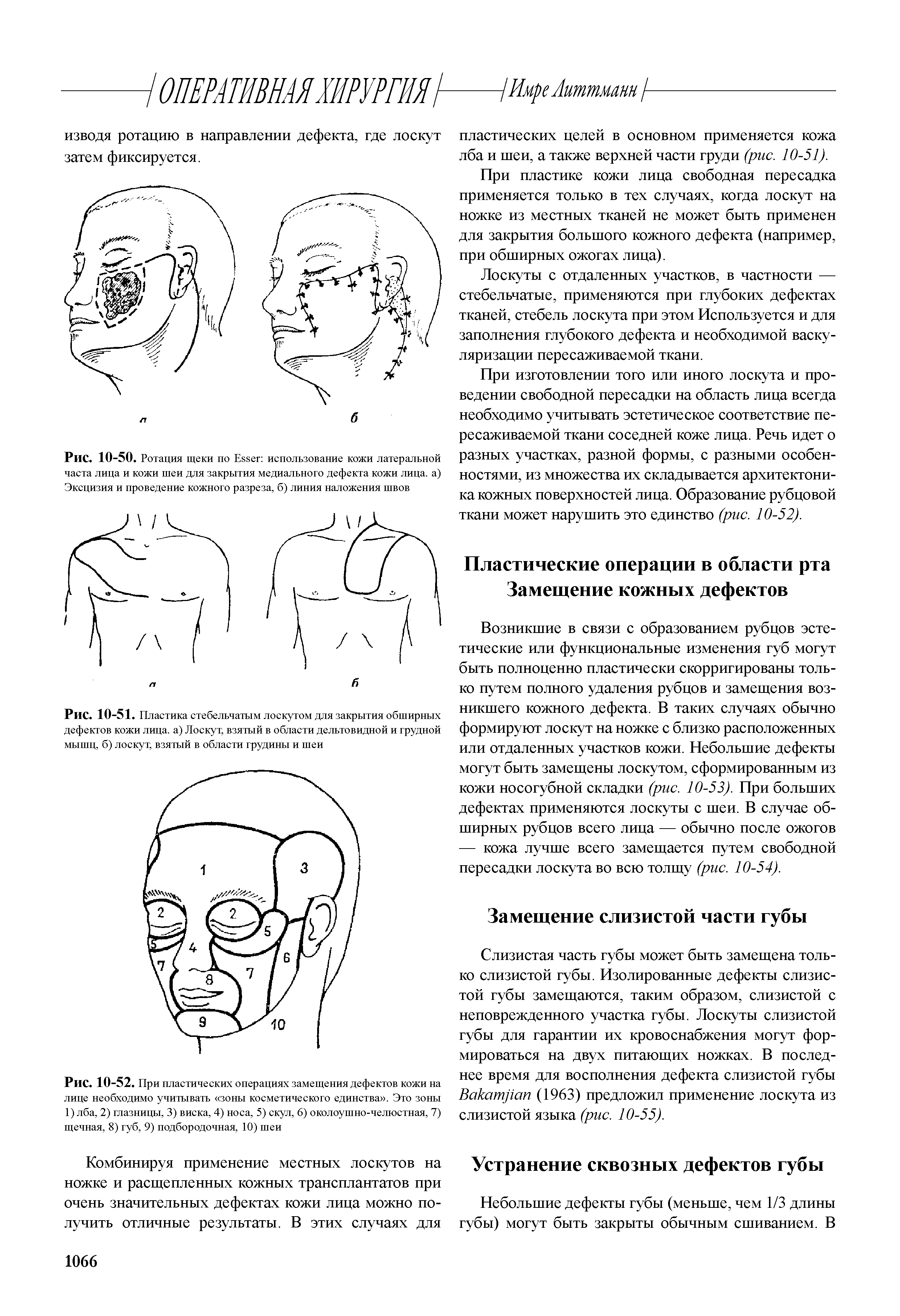 Рис. 10-52. При пластических операциях замещения дефектов кожи на лице необходимо учитывать зоны косметического единства . Это зоны 1) лба, 2) глазницы, 3) виска, 4) носа, 5) скул, 6) околоушно-челюстная, 7) щечная, 8) губ, 9) подбородочная, 10) шеи...