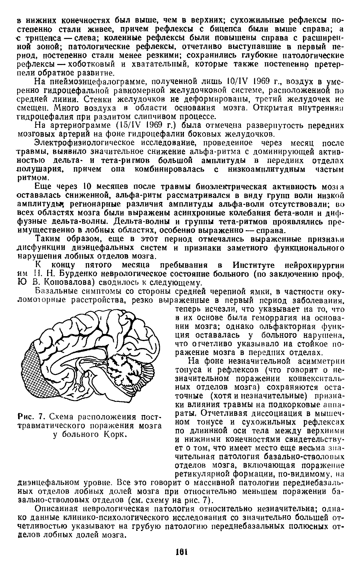 Рис. 7. Схема расположения травматического поражения у больного Корк.