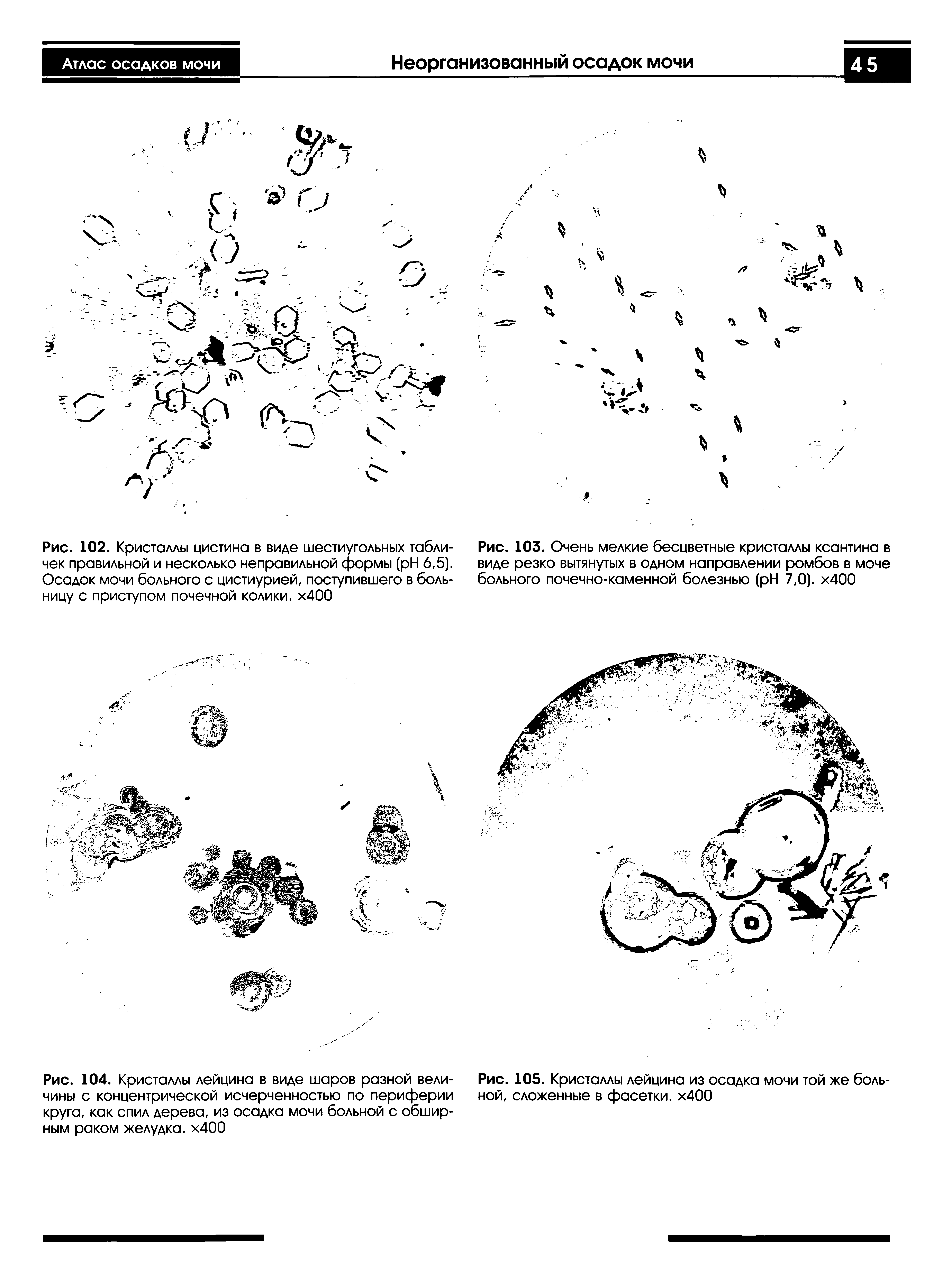 Рис. 102. Кристаллы цистина в виде шестиугольных табличек правильной и несколько неправильной формы ( H 6,5). Осадок мочи больного с цистиурией, поступившего в больницу с приступом почечной колики. х400...