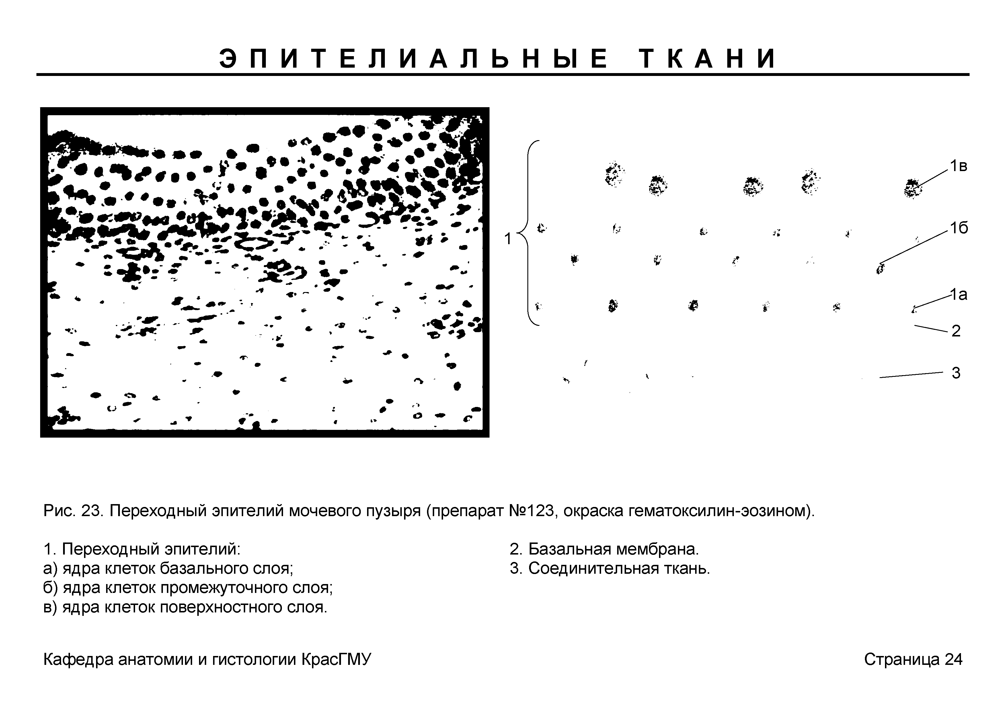 Рис. 23. Переходный эпителий мочевого пузыря (препарат №123, окраска гематоксилин-эозином).