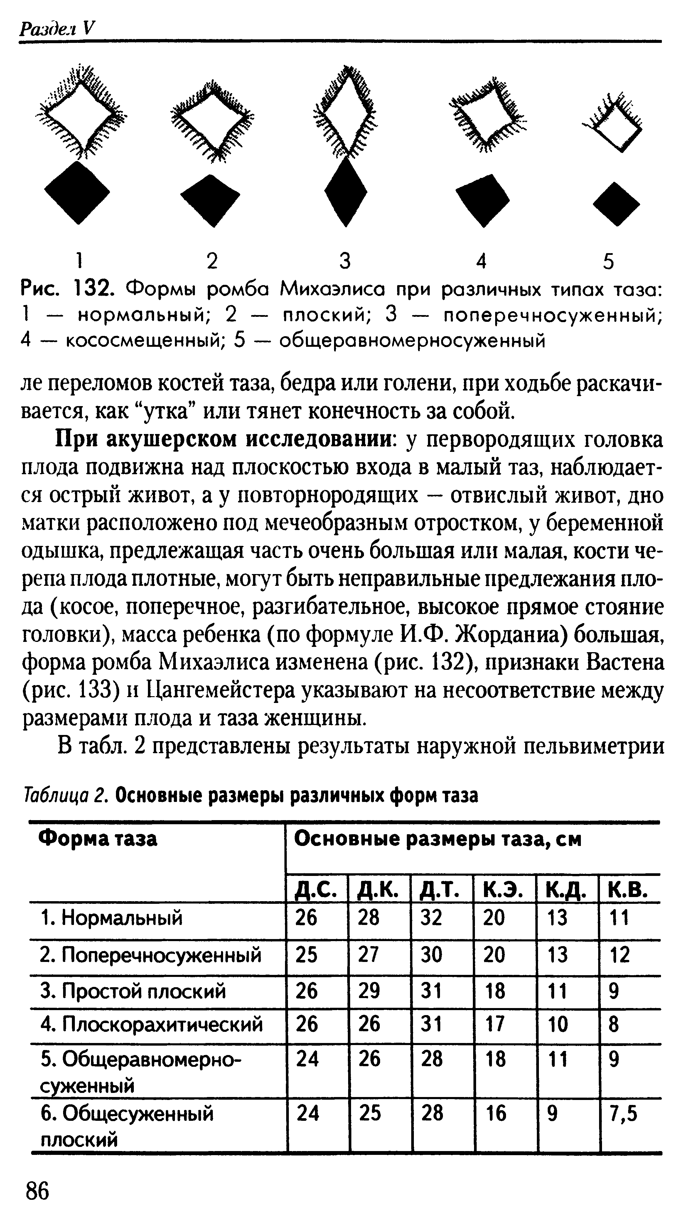 Рис. 132. Формы ромба Михаэлиса при различных типах таза 1 — нормальный 2 — плоский 3 — поперечносуженный 4 — кососмещенный 5 — общеравномерносуженный...