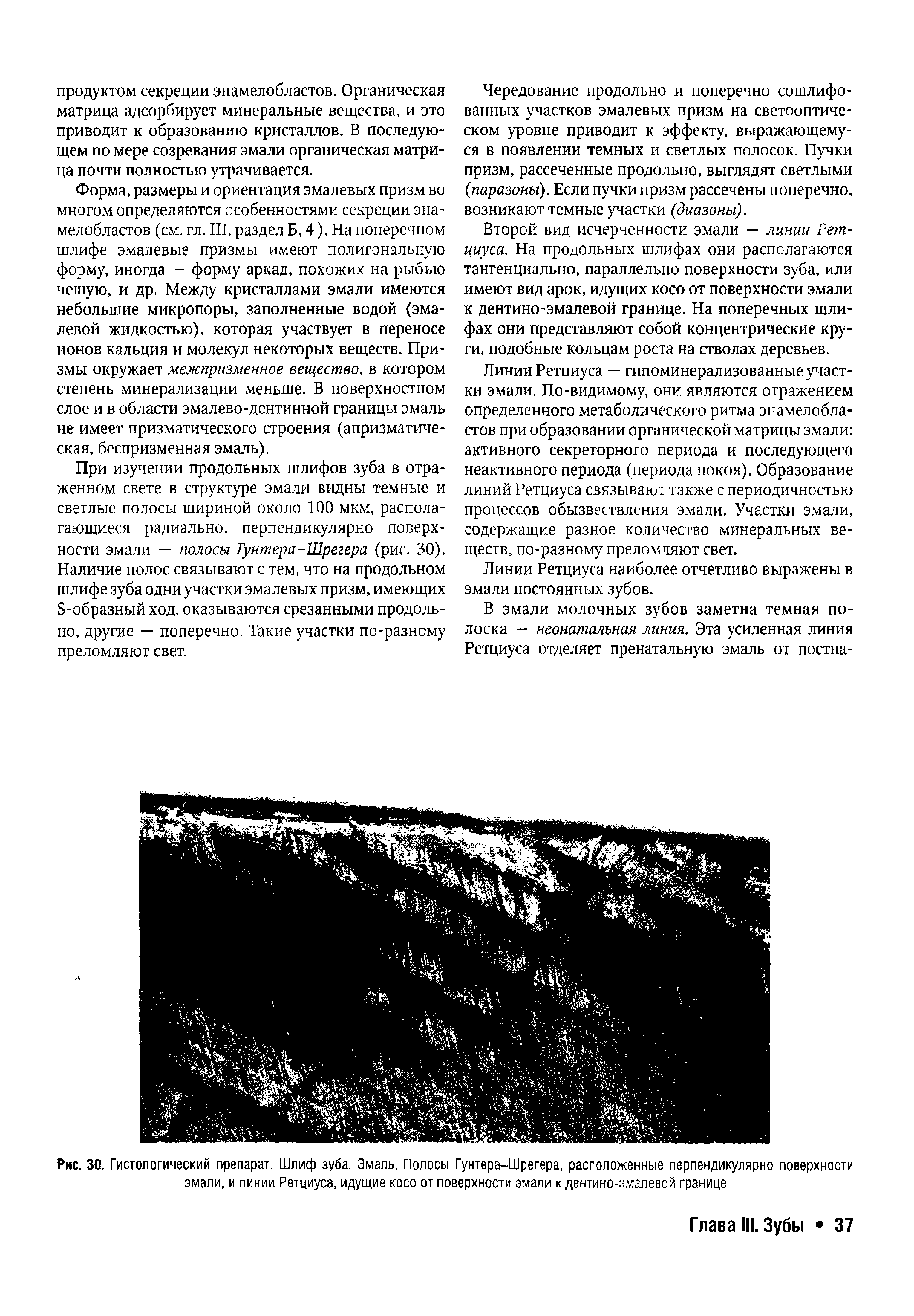 Рис. 30. Гистологический препарат. Шлиф зуба. Эмаль. Полосы Гунтера-Шрегера, расположенные перпендикулярно поверхности эмали, и линии Ретциуса, идущие косо от поверхности эмали к дентино-эмалевой границе...