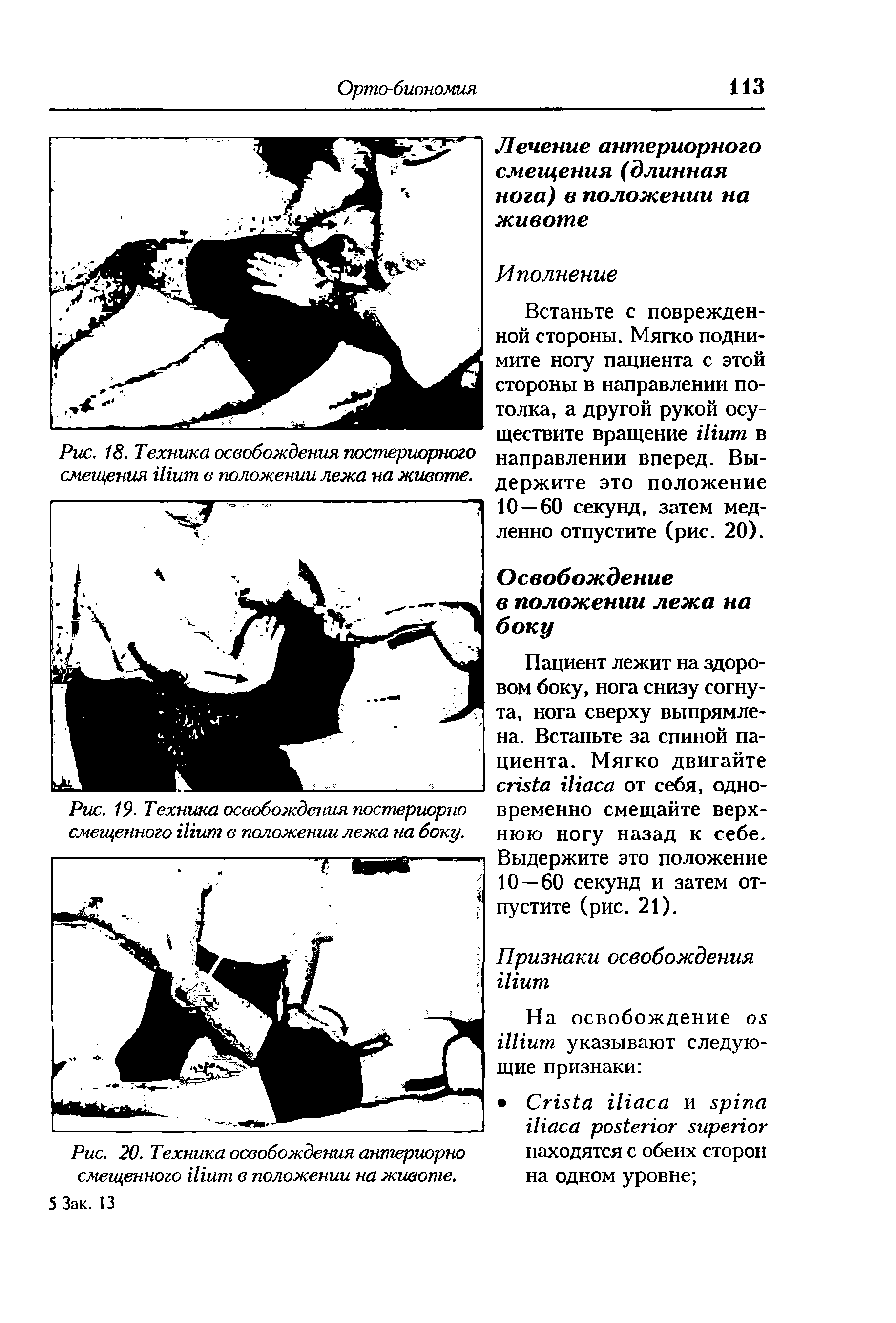 Рис. 19- Техника освобождения постериорно смещенного Шит в положении лежа на боку.