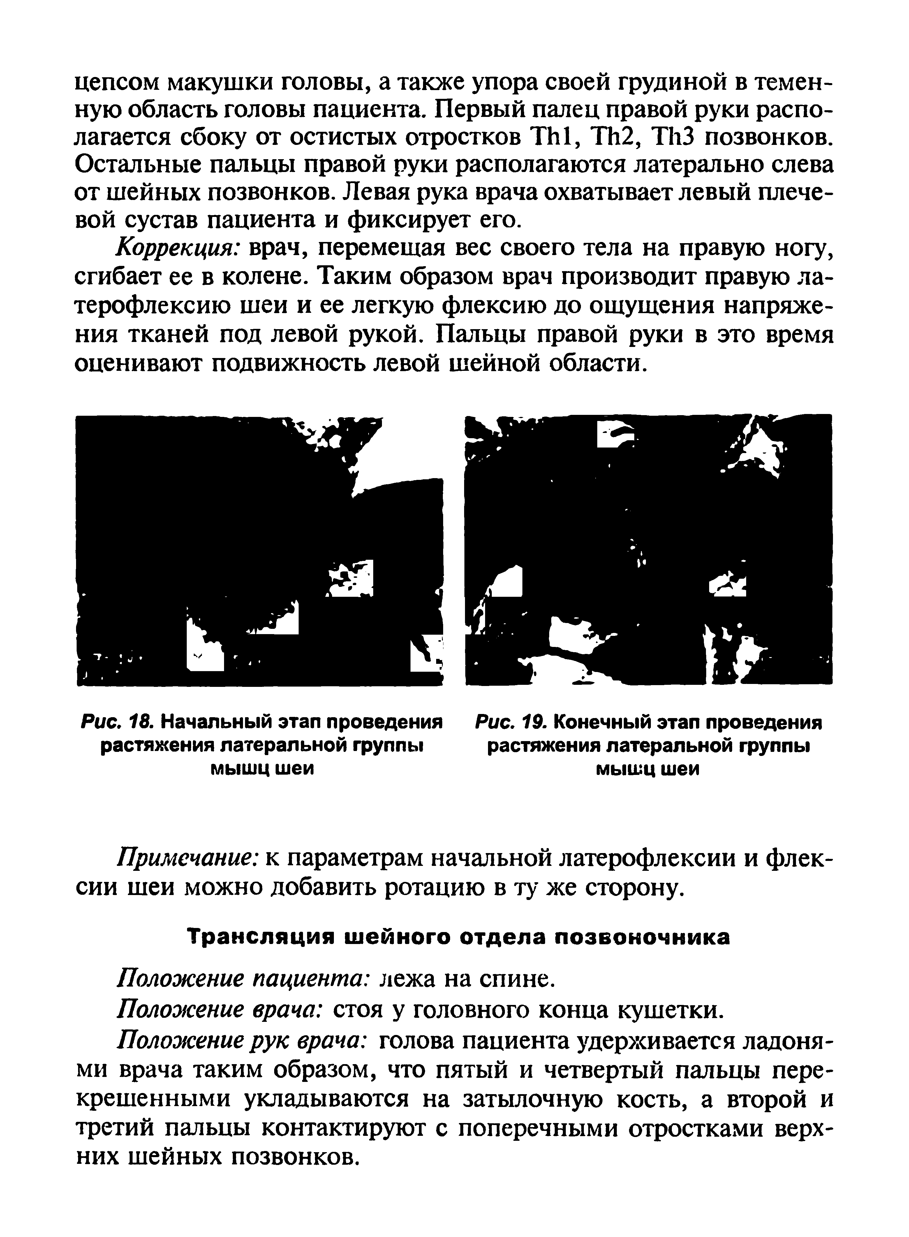 Рис. 18. Начальный этап проведения Рис. 19. Конечный этап проведения растяжения латеральной группы растяжения латеральной группы мышц шеи мышц шеи...