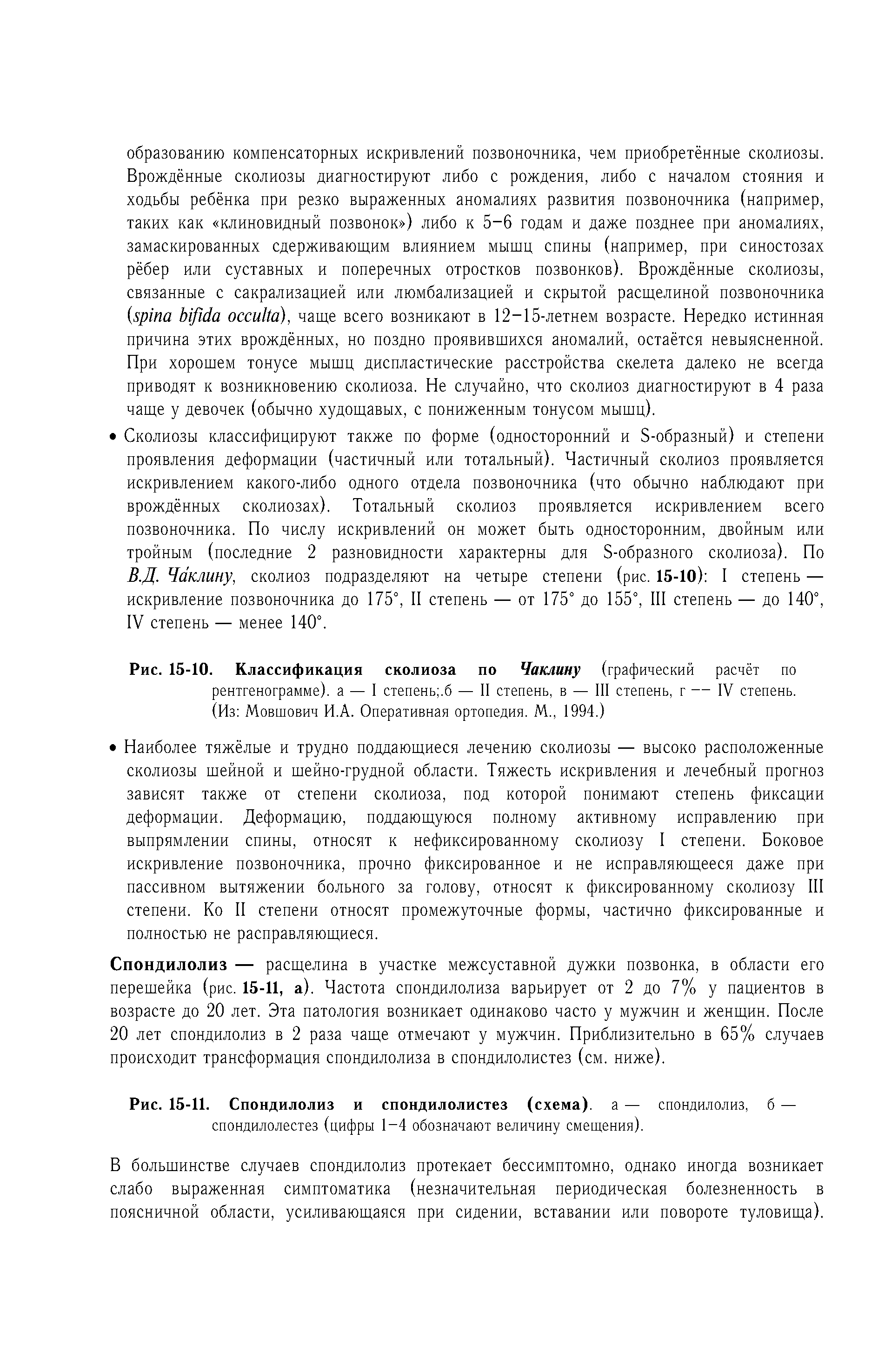 Рис. 15-10. Классификация сколиоза по Чаклину (графический расчёт по рентгенограмме), а — I степень .б — II степень, в — III степень, г — IV степень. (Из Мовшович И.А. Оперативная ортопедия. М., 1994.)...