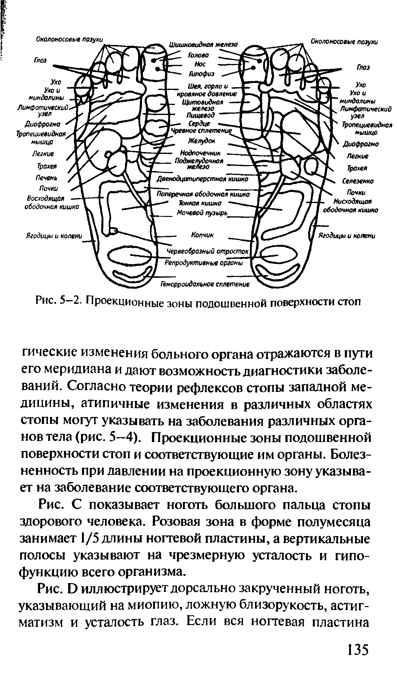 Рис. Э иллюстрирует дорсально закрученный ноготь, указывающий на миопию, ложную близорукость, астигматизм и усталость глаз. Если вся ногтевая пластина...