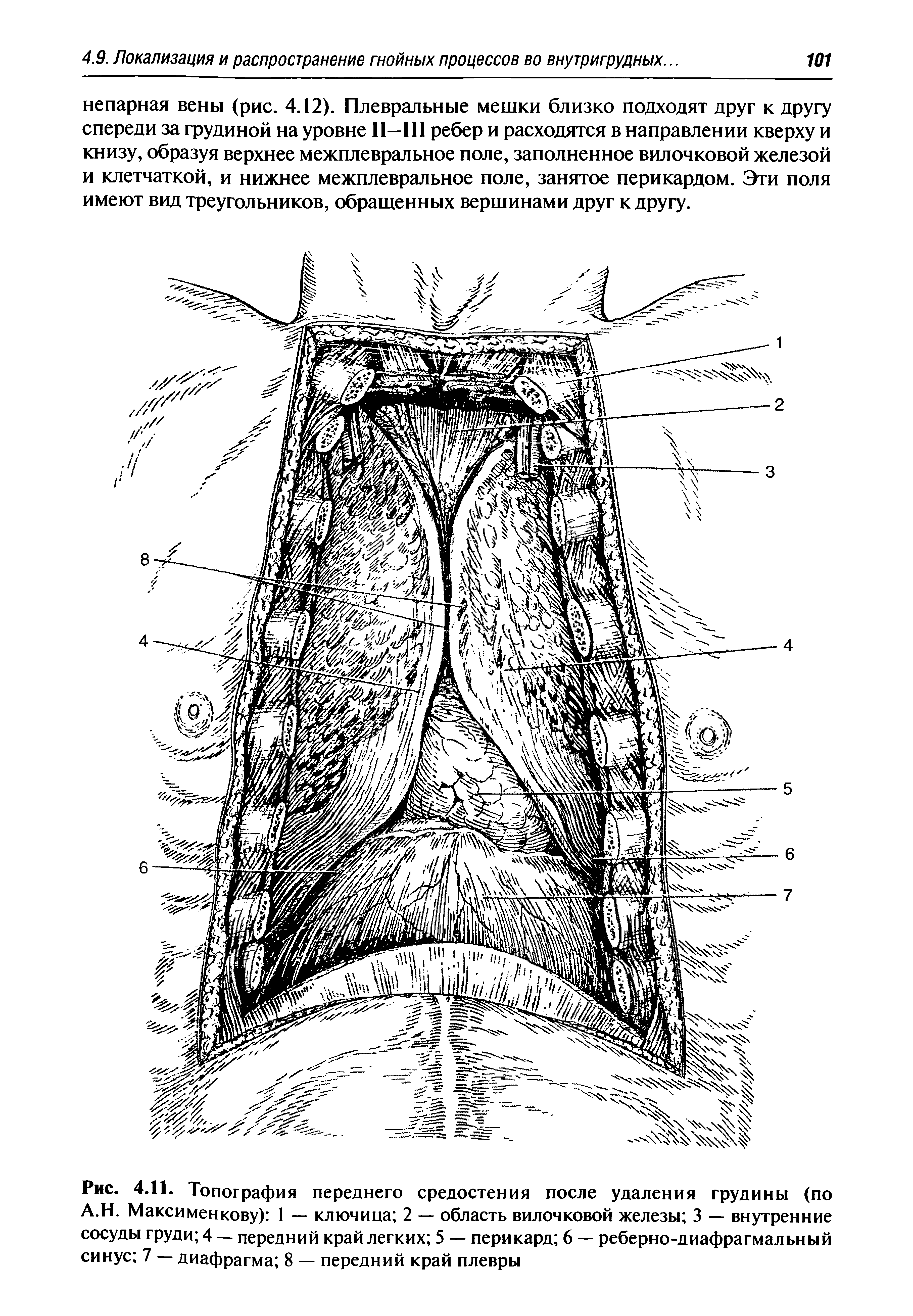 Рис. 4.11. Топография переднего средостения после удаления грудины (по А.Н. Максименкову) 1 — ключица 2 — область вилочковой железы 3 — внутренние сосуды груди 4 — передний край легких 5 — перикард 6 — реберно-диафрагмальный синус 7 — диафрагма 8 — передний край плевры...