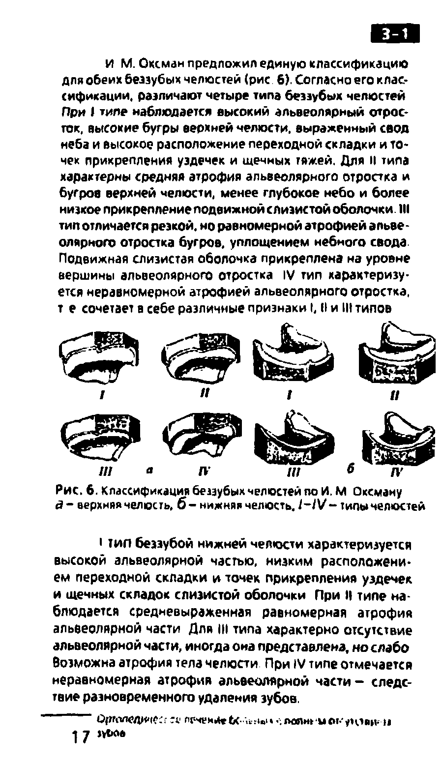 Рис. 6. Классификация беззубых челюстей по И. М Оксману <3- верхняя челюсть, б - нижняя челюсть. типы челюстей...