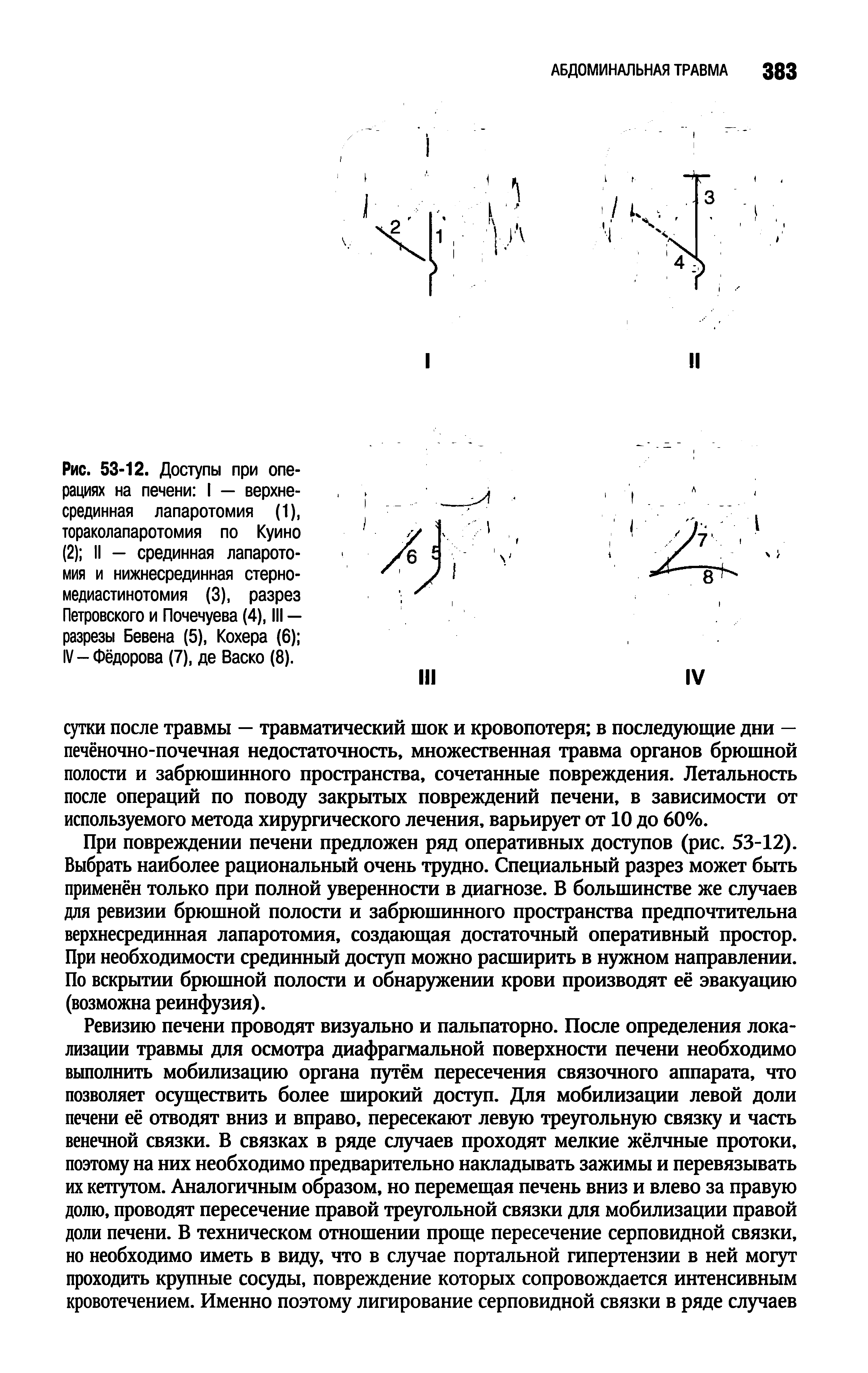Рис. 53-12. Доступы при операциях на печени I — верхнесрединная лапаротомия (1), тораколапаротомия по Куино (2) II — срединная лапаротомия и нижнесрединная стерно-медиастинотомия (3), разрез Петровского и Почечуева (4), III — разрезы Бевена (5), Кохера (6) IV - Фёдорова (7), де Васко (8).