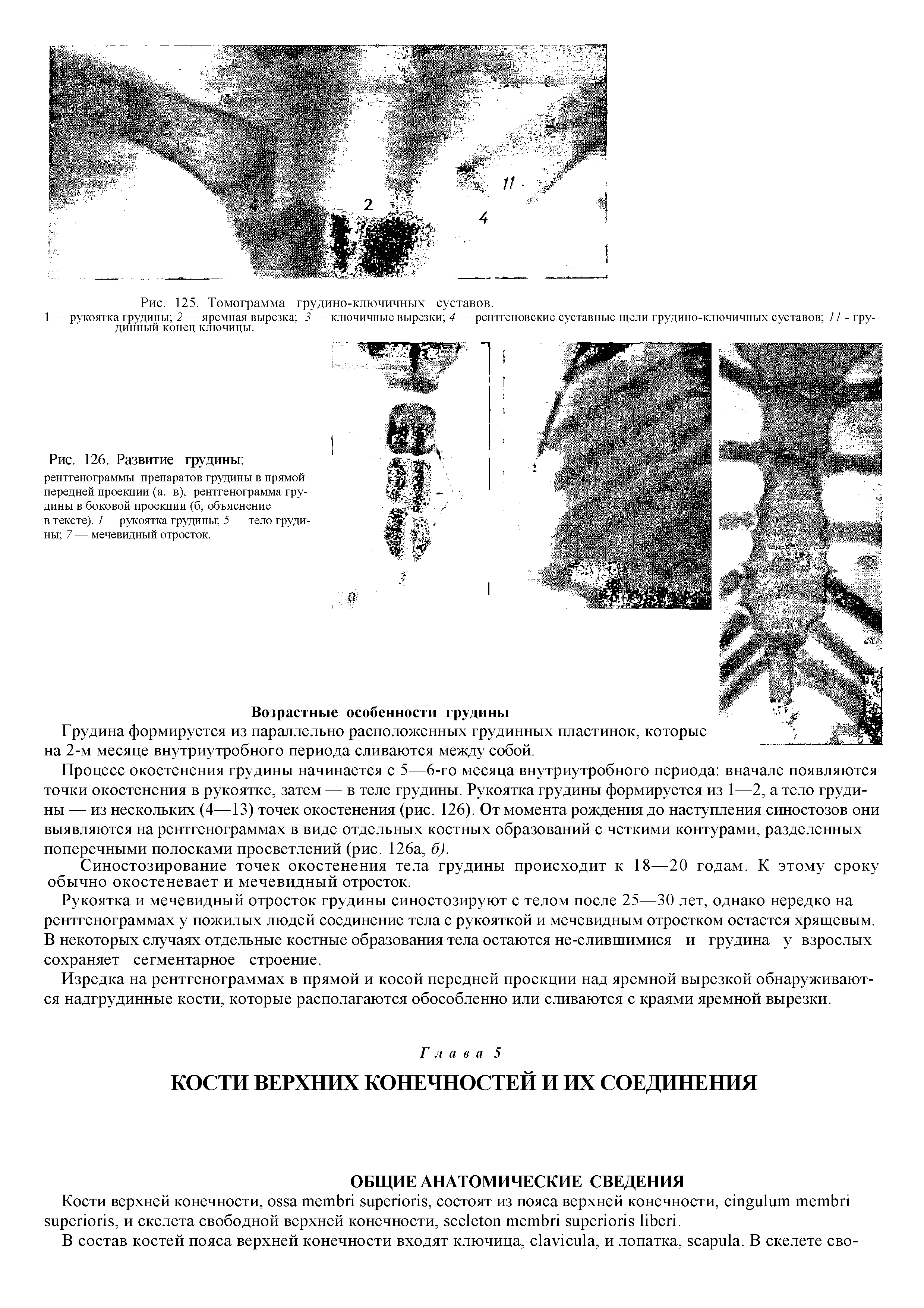 Рис. 126. Развитие грудины рентгенограммы препаратов грудины в прямой передней проекции (а. в), рентгенограмма грудины в боковой проекции (б, объяснение в тексте). 1 —рукоятка грудины 5 — тело грудины 7 — мечевидный отросток.