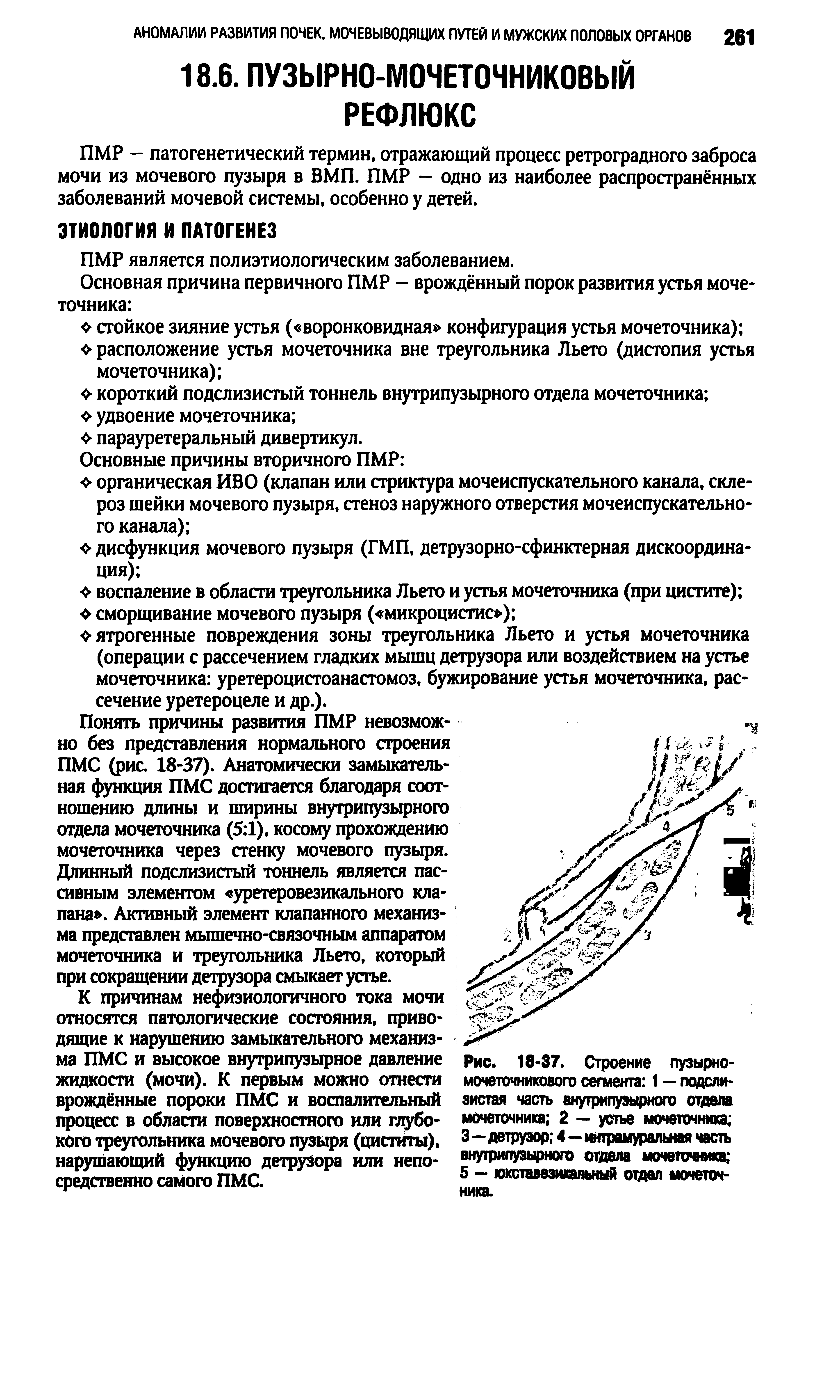 Рис. 18-37. Строение мочеточникового сегмента 1 — подслизистая часть внутрипузырного отдав мочеточника 2 — устье мочеточника 3—детрузор 4—интрамуральная часть внутрипузырного отдела мочетошика 5 — юкставезикальный отдел мочеточника.