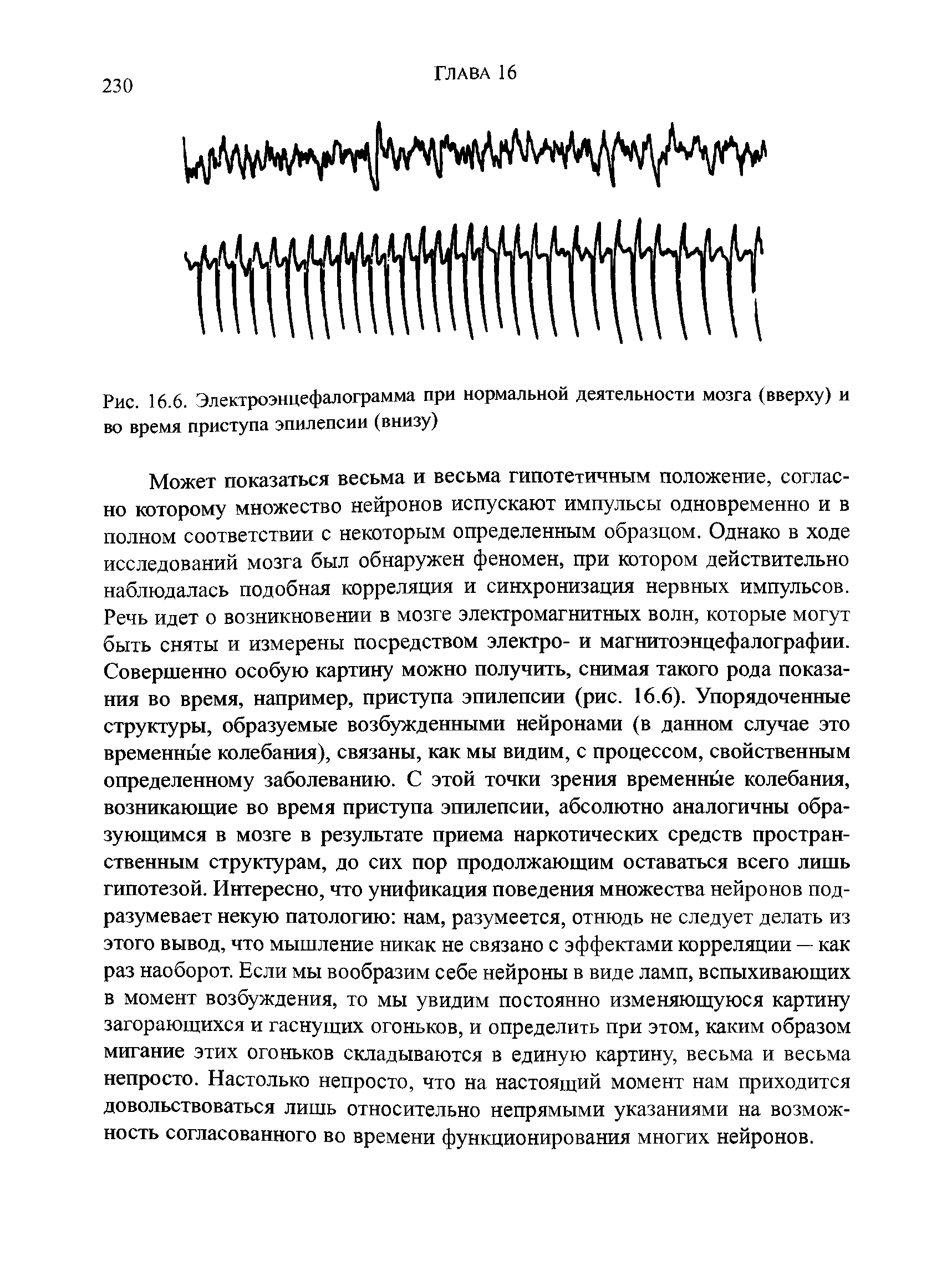 Рис. 16.6. Электроэнцефалограмма при нормальной деятельности мозга (вверху) и во время приступа эпилепсии (внизу)...