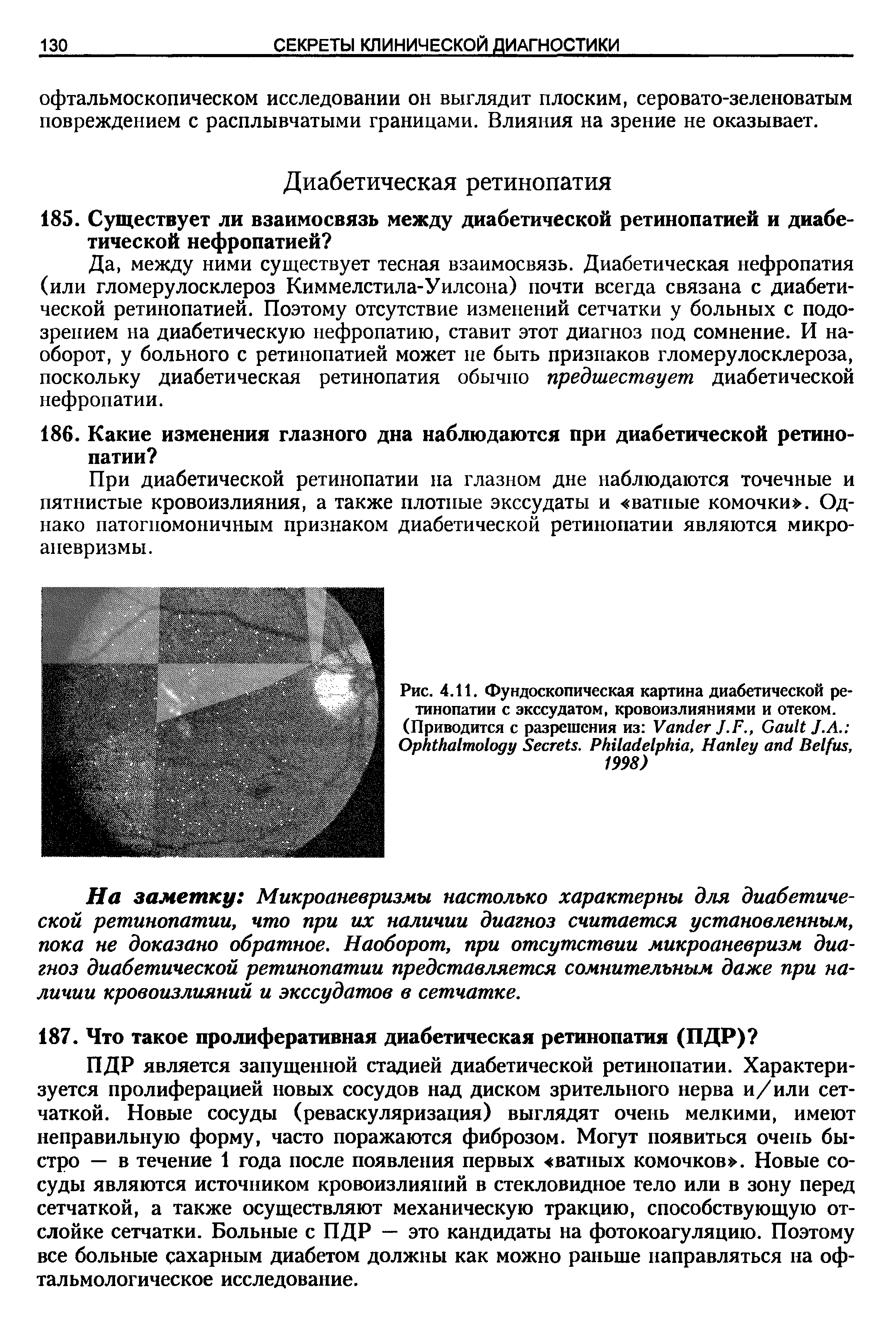 Рис. 4.11. Фундоскопическая картина диабетической ретинопатии с экссудатом, кровоизлияниями и отеком.