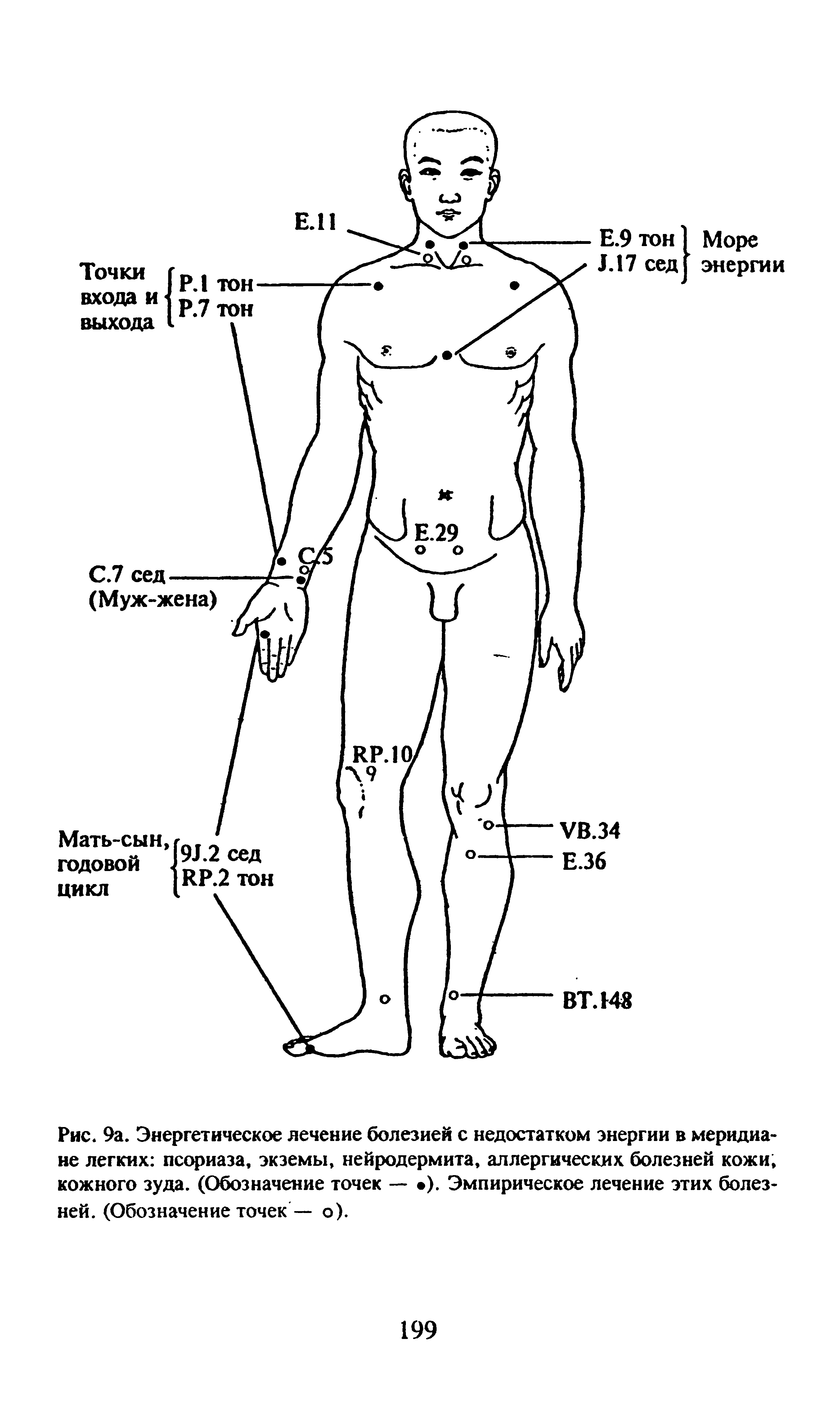 Рис. 9а. Энергетическое лечение болезней с недостатком энергии в меридиане легких псориаза, экземы, нейродермита, аллергических болезней кожи, кожного зуда. (Обозначение точек — ). Эмпирическое лечение этих болезней. (Обозначение точек — о).