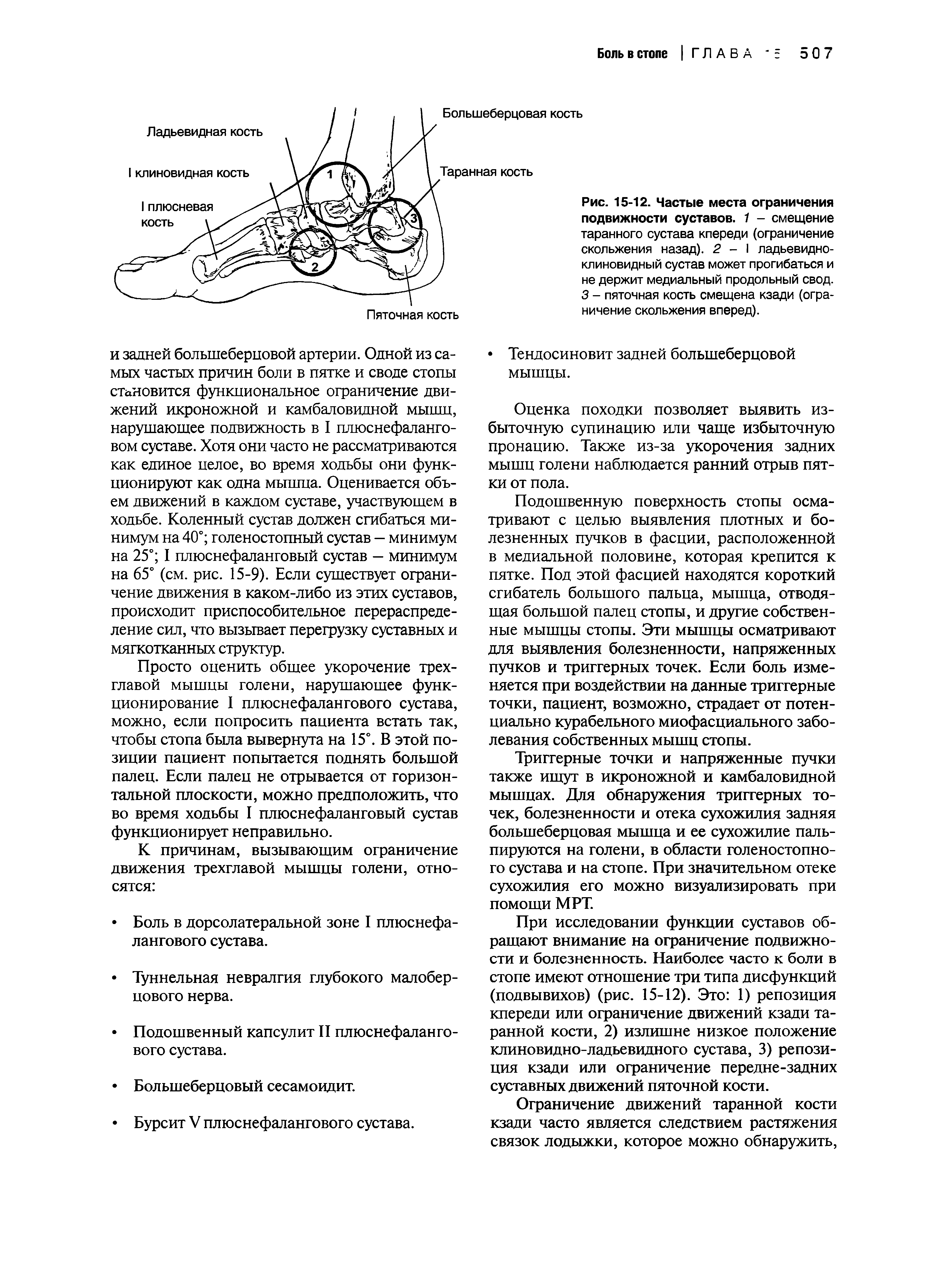 Рис. 15-12. Частые места ограничения подвижности суставов. 1 - смещение таранного сустава кпереди (ограничение скольжения назад). 2 - I ладьевидноклиновидный сустав может прогибаться и не держит медиальный продольный свод. 3 - пяточная кость смещена кзади (ограничение скольжения вперед).