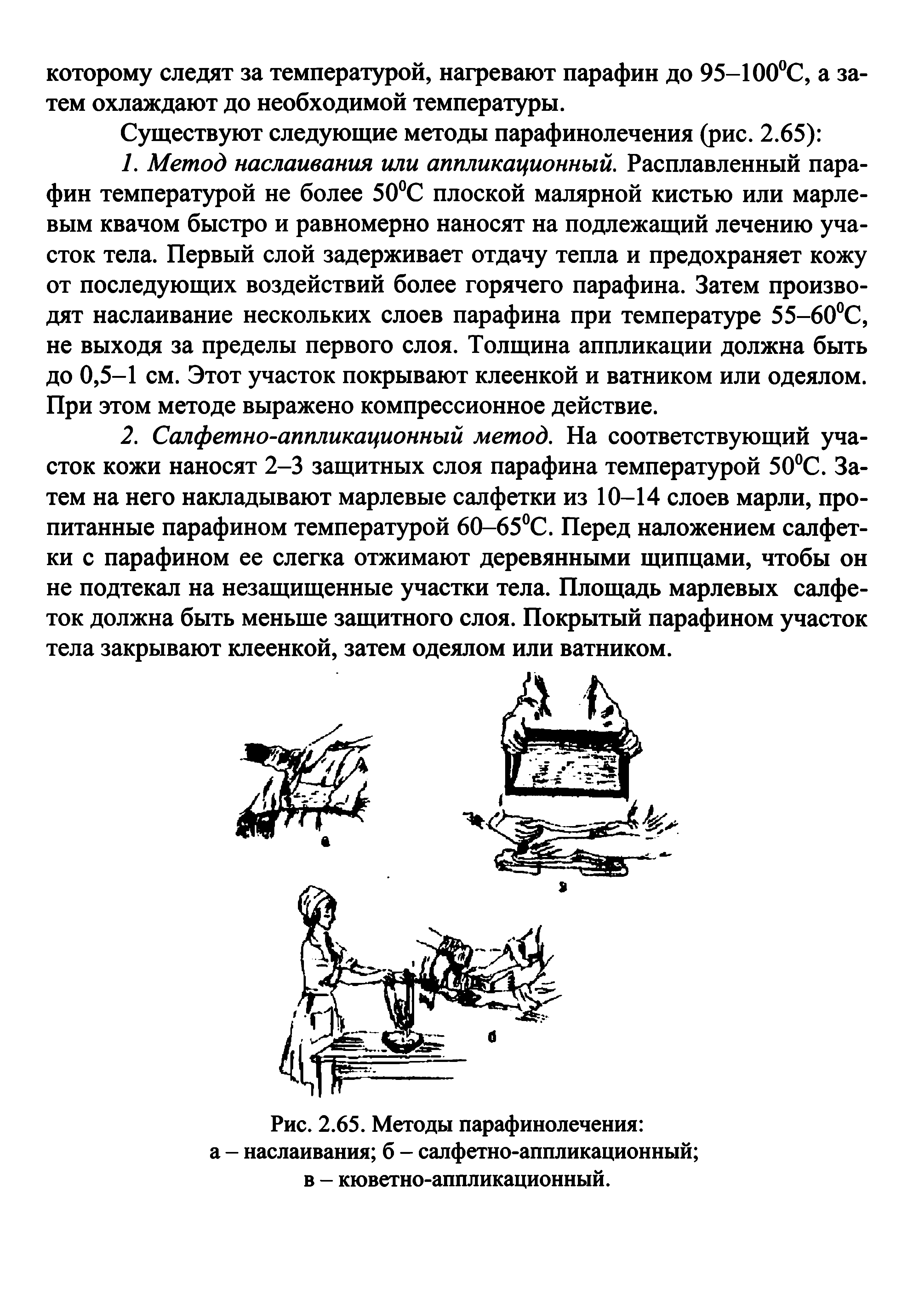 Рис. 2.65. Методы парафинолечения а - наслаивания б - салфетно-аппликационный в - кюветно-аппликационный.