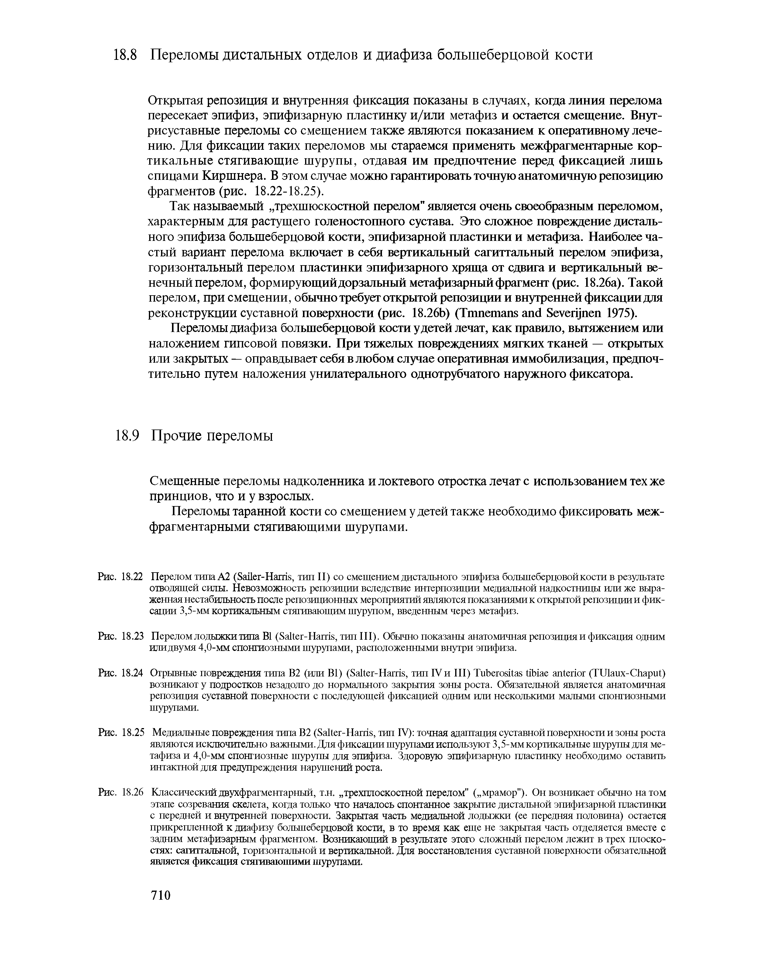 Рис. 18.23 Перелом лодыжки типа B (S -H , тип III). Обычно показаны анатомичная репозиция и фиксация одним илидвумя 4,0-мм спонгиозными шурупами, расположенными внутри эпифиза.