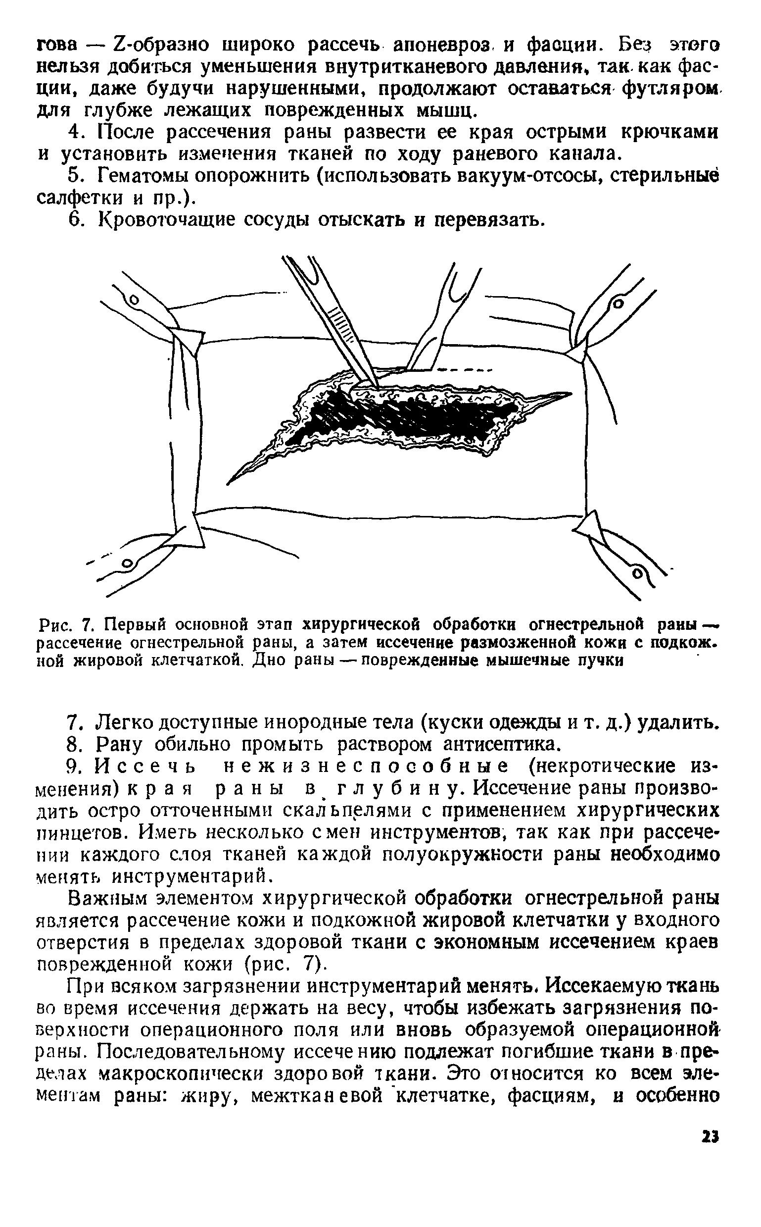 Рис. 7. Первый основной этап хирургической обработки огнестрельной раны — рассечение огнестрельной раны, а затем иссечение размозженной кожи с подкож. ной жировой клетчаткой. Дно раны — поврежденные мышечные пучки...