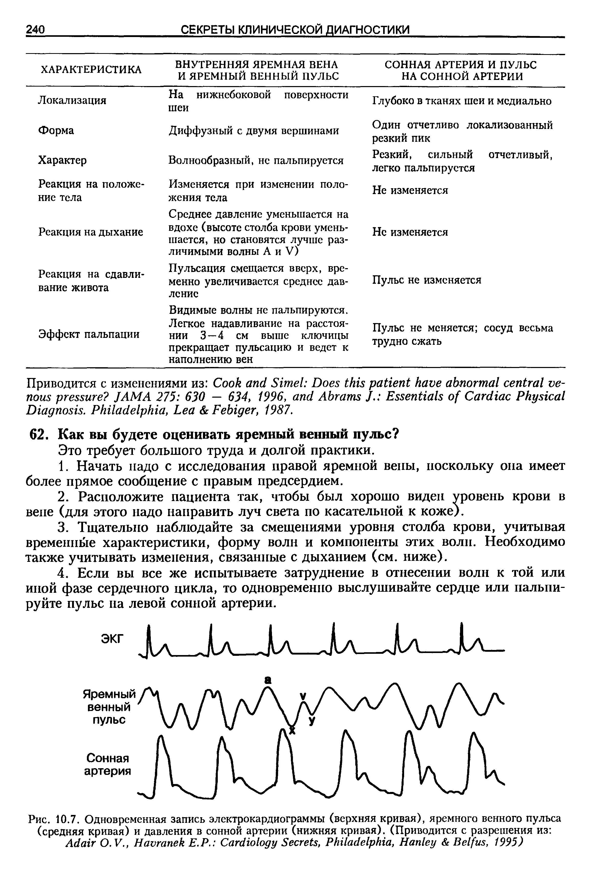 Рис. 10.7. Одновременная запись электрокардиограммы (верхняя кривая), яремного венного пульса (средняя кривая) и давления в сонной артерии (нижняя кривая). (Приводится с разрешения из A O.V., H Е.Р. C S , P , H B , 1995)...