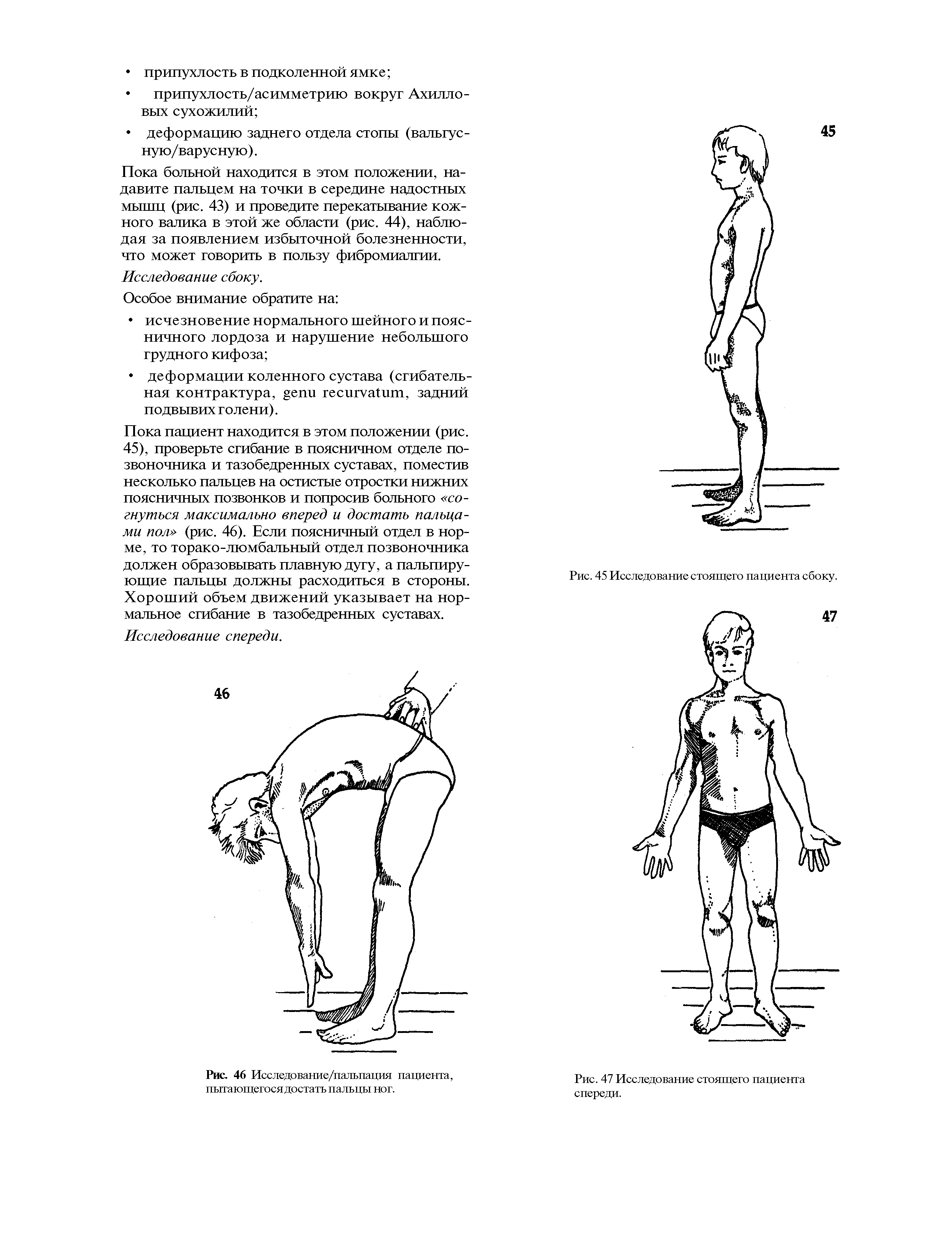 Рис. 46 Исследование/пальпация пациента, пытающегося достать пальцы ног.