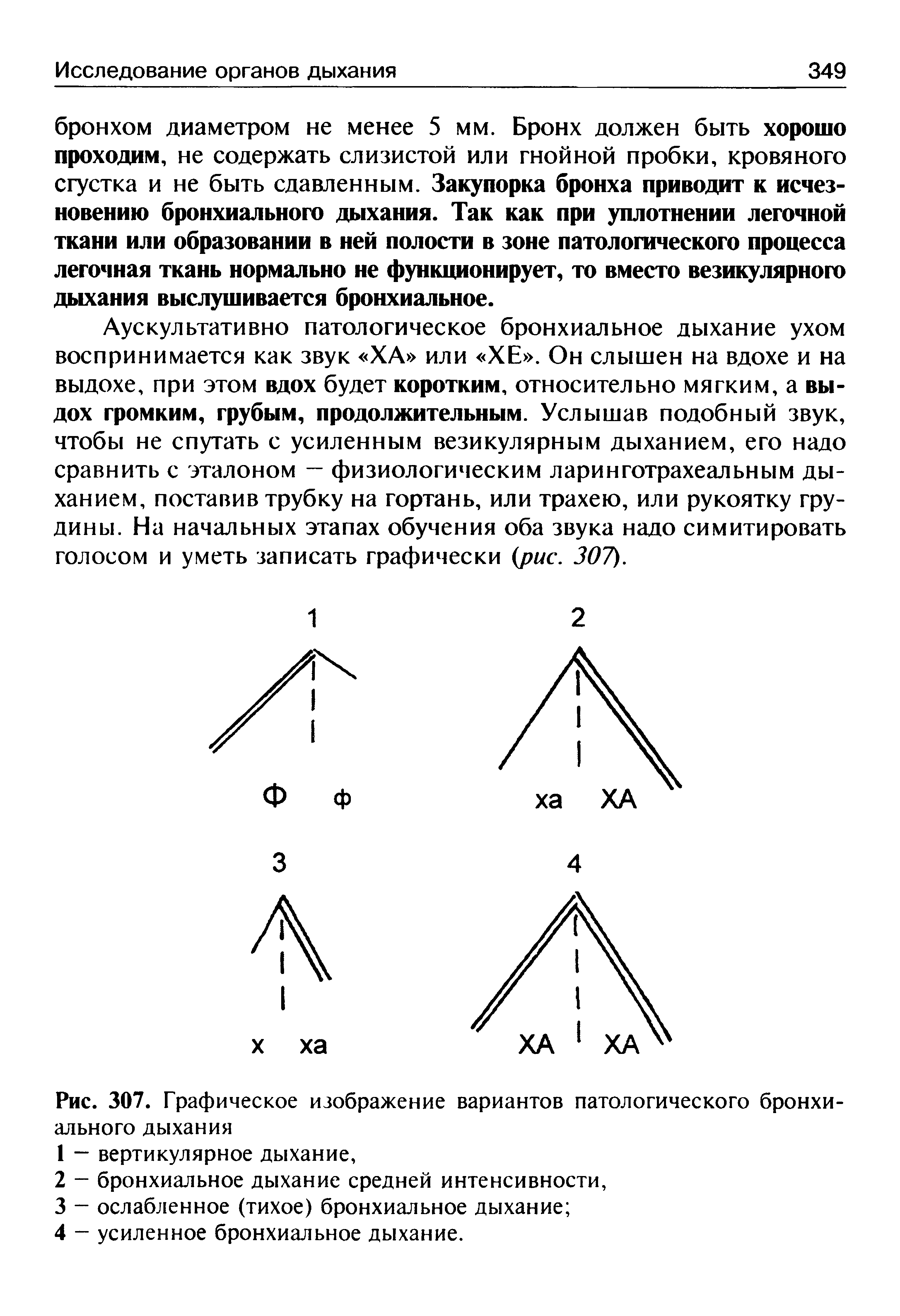 Рис. 307. Графическое изображение вариантов патологического бронхиального дыхания...