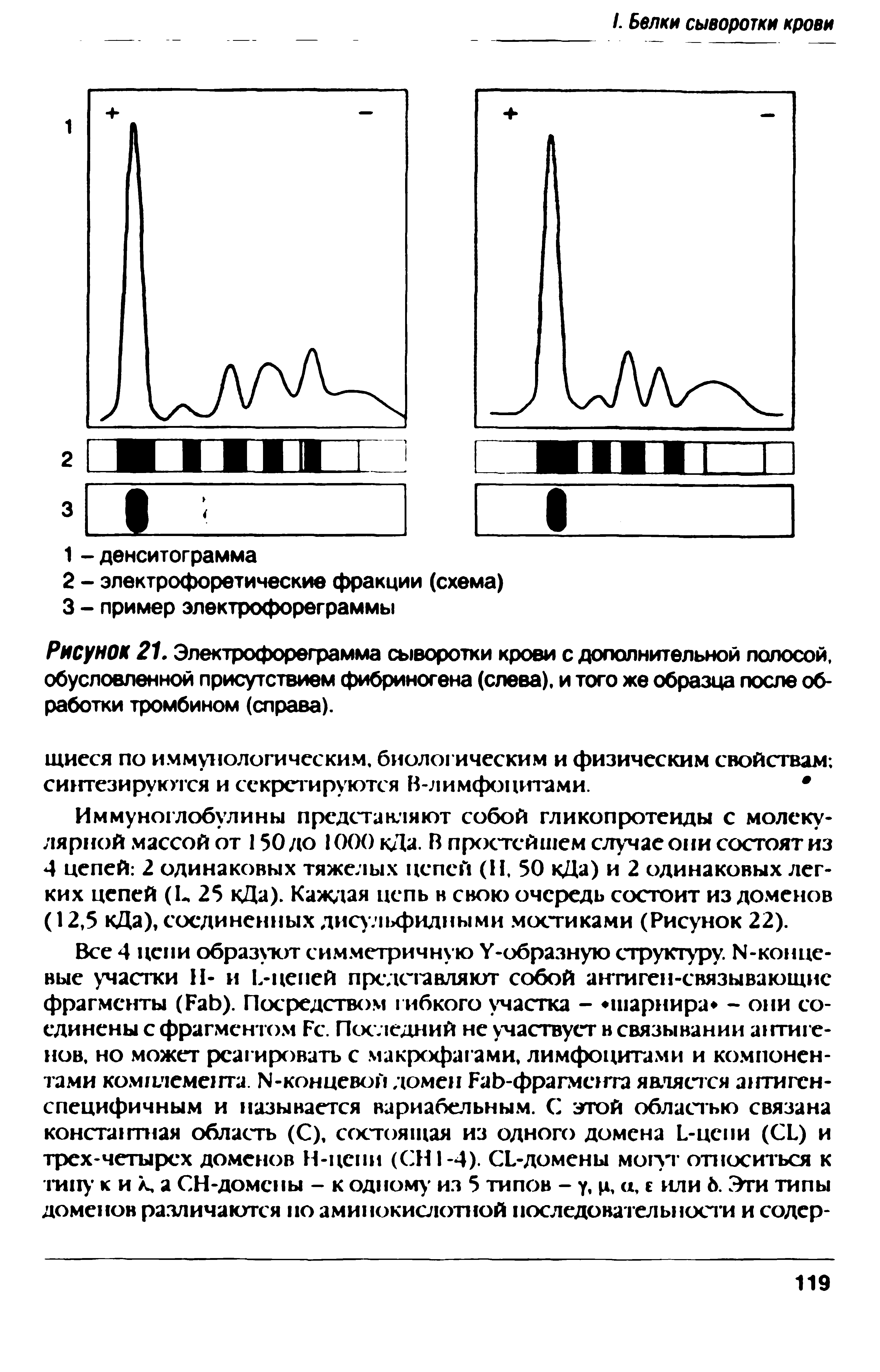 Рисунок 21. Электрофореграмма сыворотки крови с дополнительной полосой, обусловленной присутствием фибриногена (слева), и того же образца после обработки тромбином (справа).