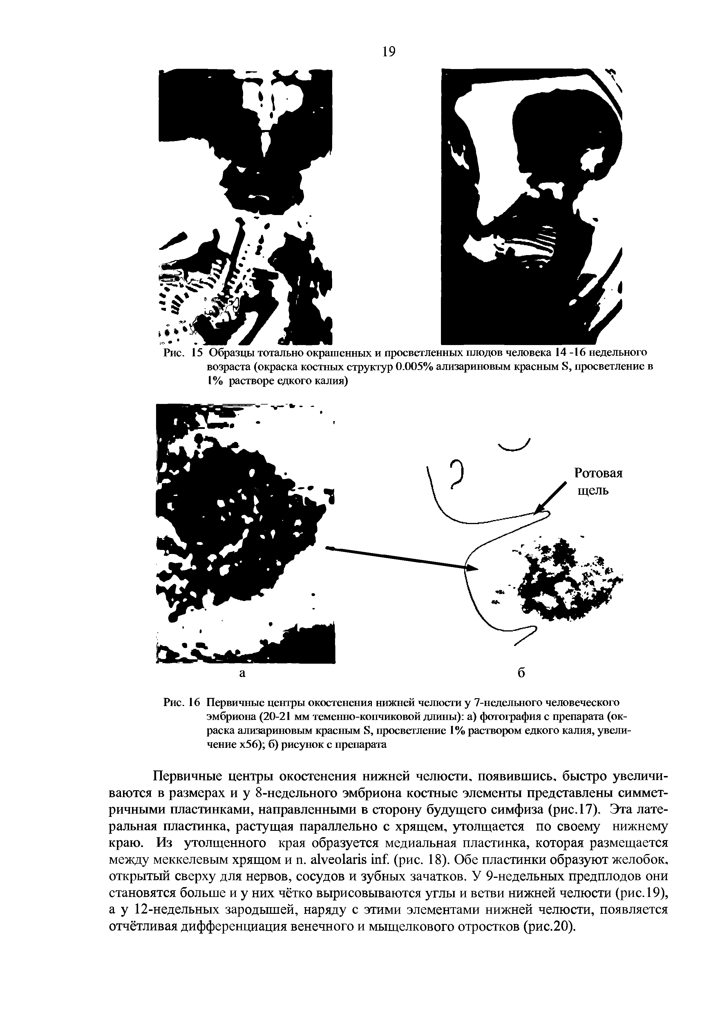 Рис. 16 Первичные центры окостенения нижней челюсти у 7-недельного человеческого эмбриона (20-21 мм теменно-копчиковой длины) а) фотография с препарата (окраска ализариновым красным S, просветление 1% раствором едкого калия, увеличение х56) б) рисунок с препарата...