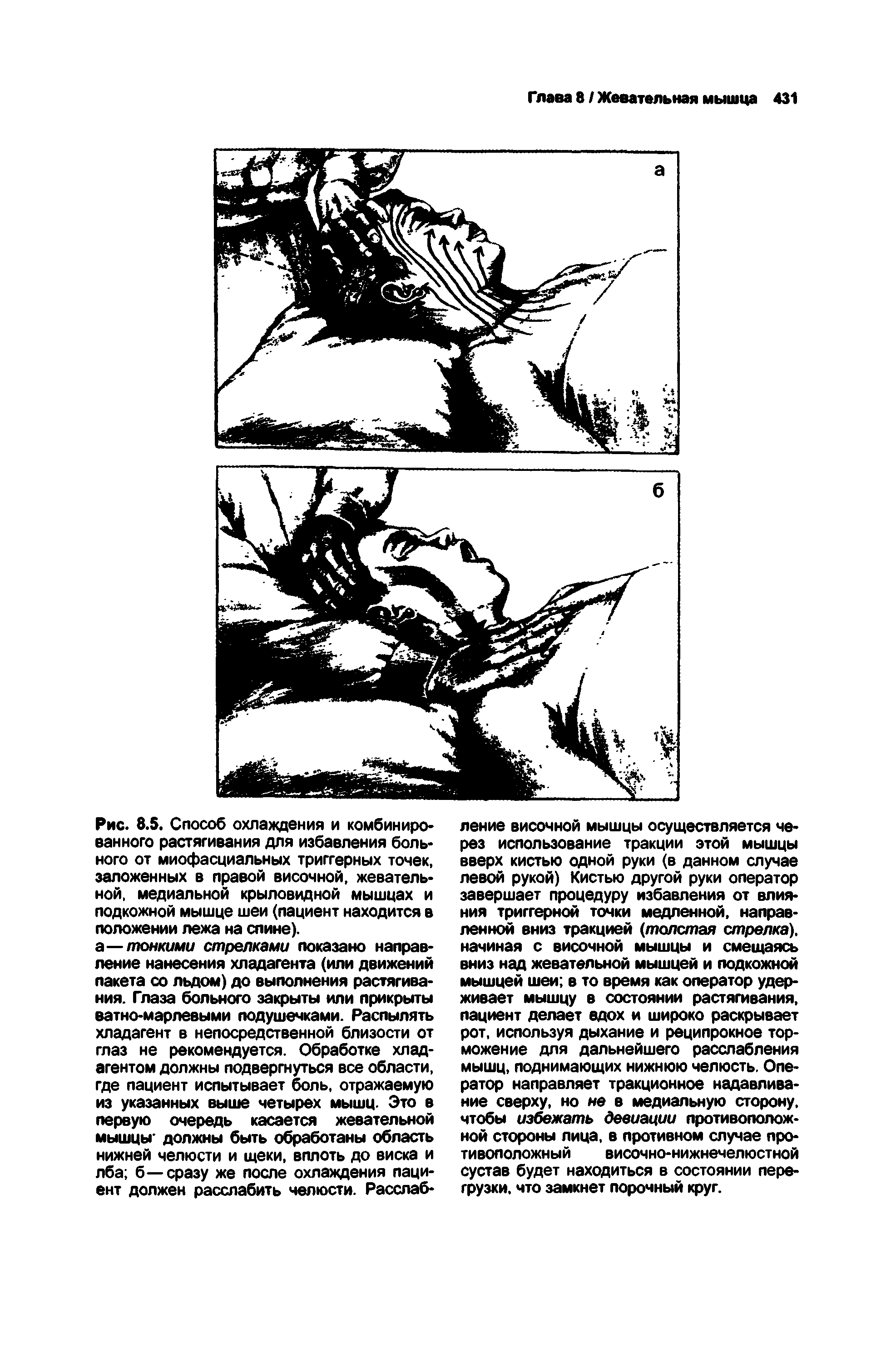 Рис. 8.5. Способ охлаждения и комбинированного растягивания для избавления больного от миофасциальных триггерных точек, заложенных в правой височной, жевательной, медиальной крыловидной мышцах и подкожной мышце шеи (пациент находится в положении лежа на спине).