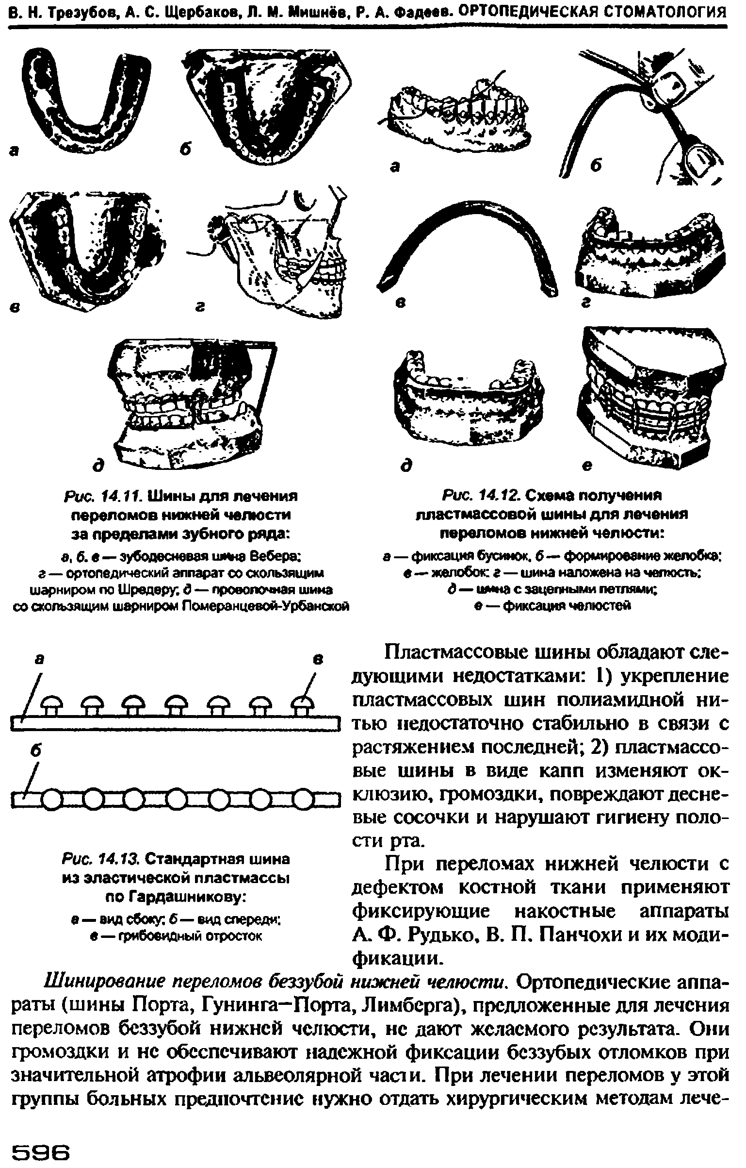 Рис. 14.13. Стандартная шина из эластической пластмассы ло Гардашникову а—вид сбоку б — вид спереди ...