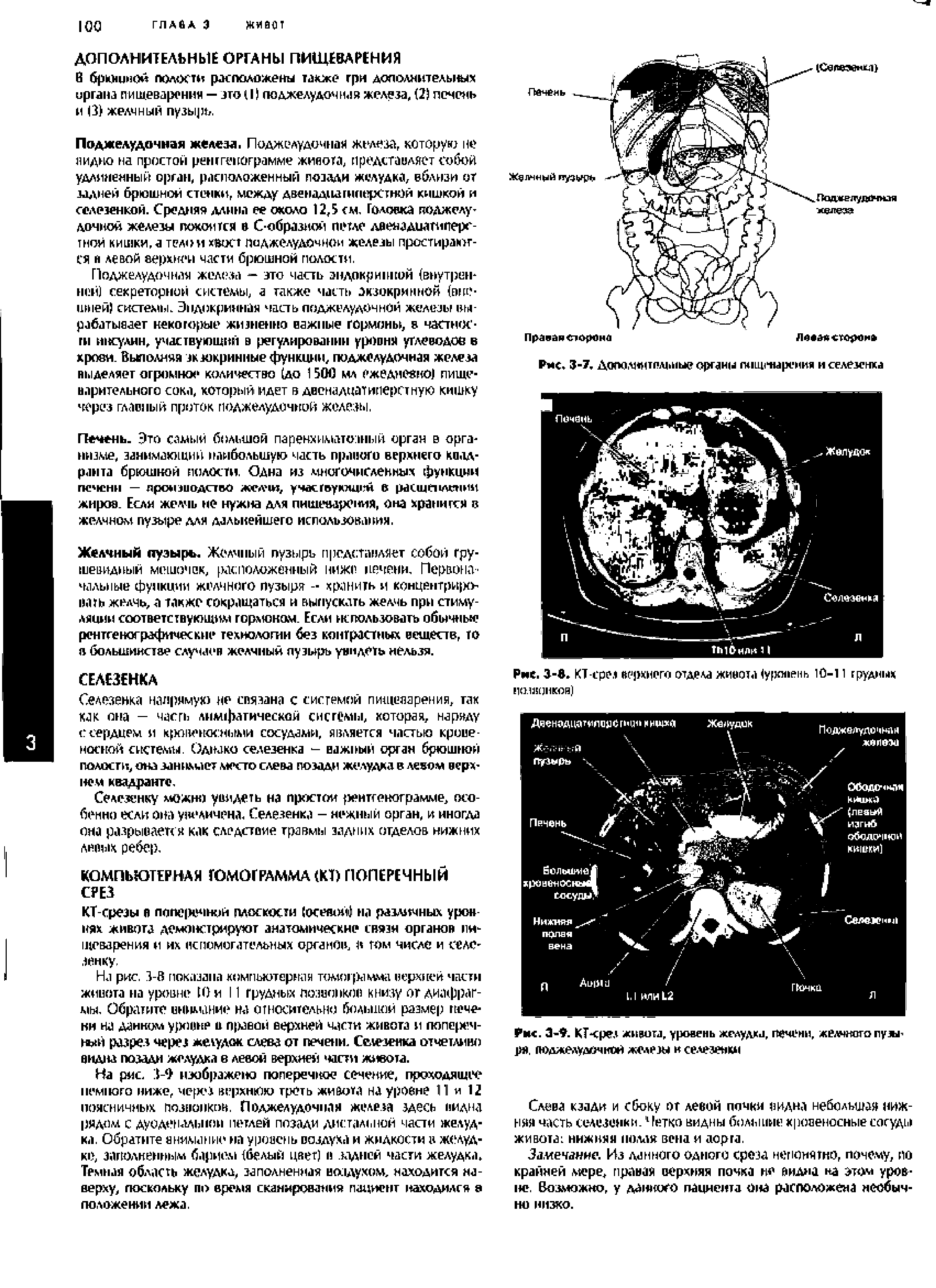 Рис. 3-9. КТ-срез живота, уровень желудка, печени, желчного пуле ря, тюджелулгэчней железы и селезенки...