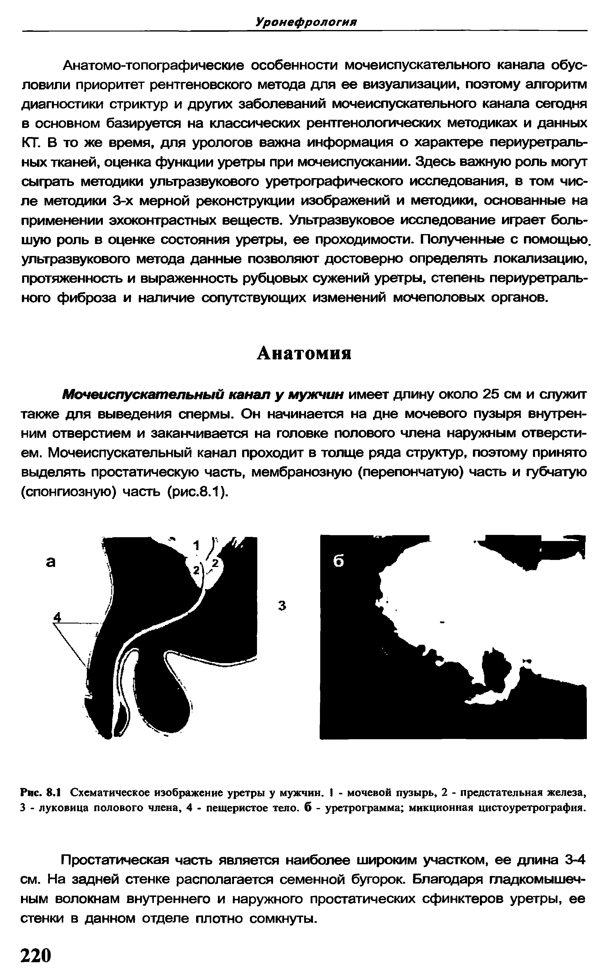 Рис. 8.1 Схематическое изображение уретры у мужчин. I - мочевой пузырь, 2 - предстательная железа, 3 - луковица полового члена, 4 - пещеристое тело, б - уретрограмма микционная цистоуретрография.