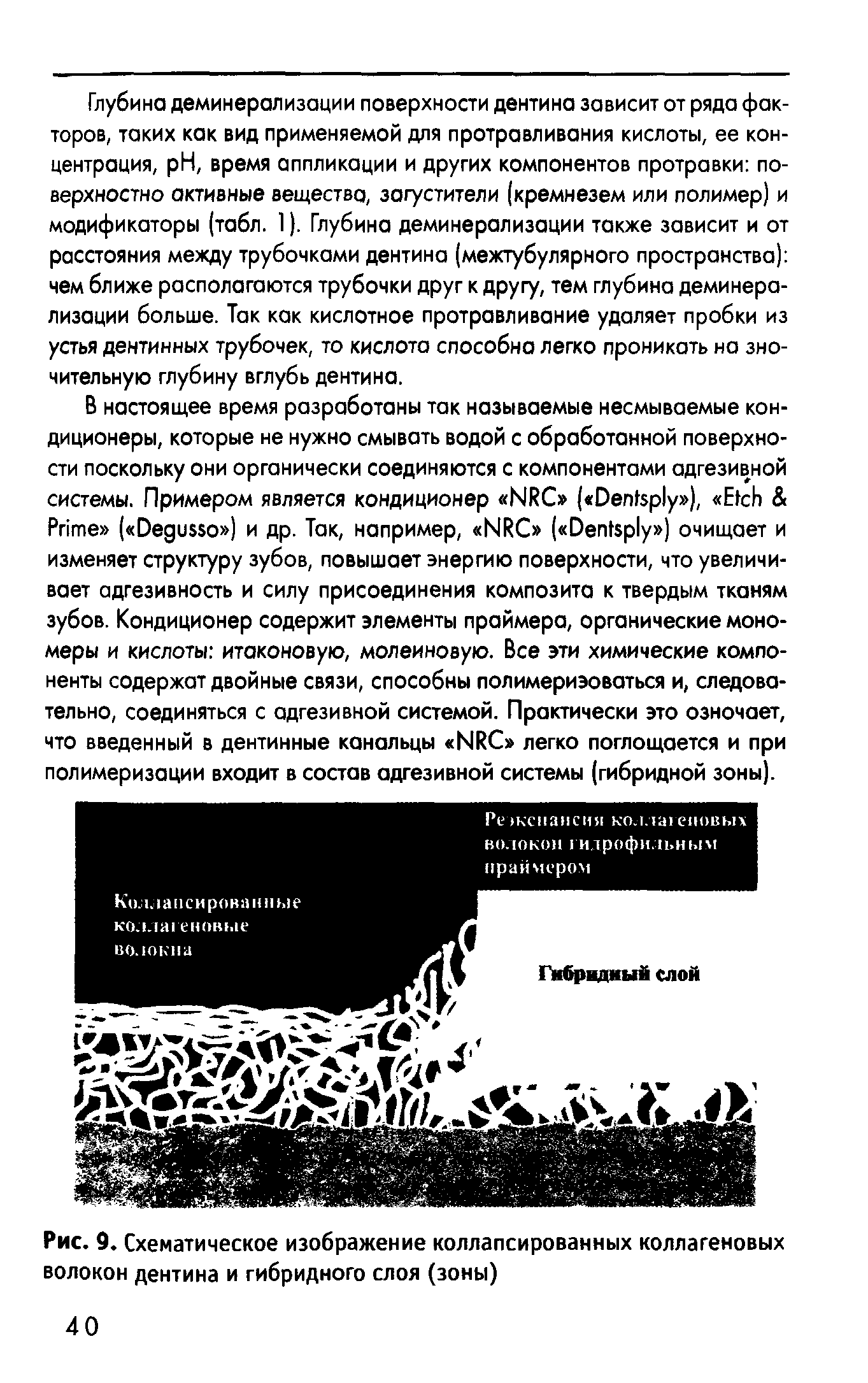 Рис. 9. Схематическое изображение коллапсированных коллагеновых волокон дентина и гибридного слоя (зоны)...