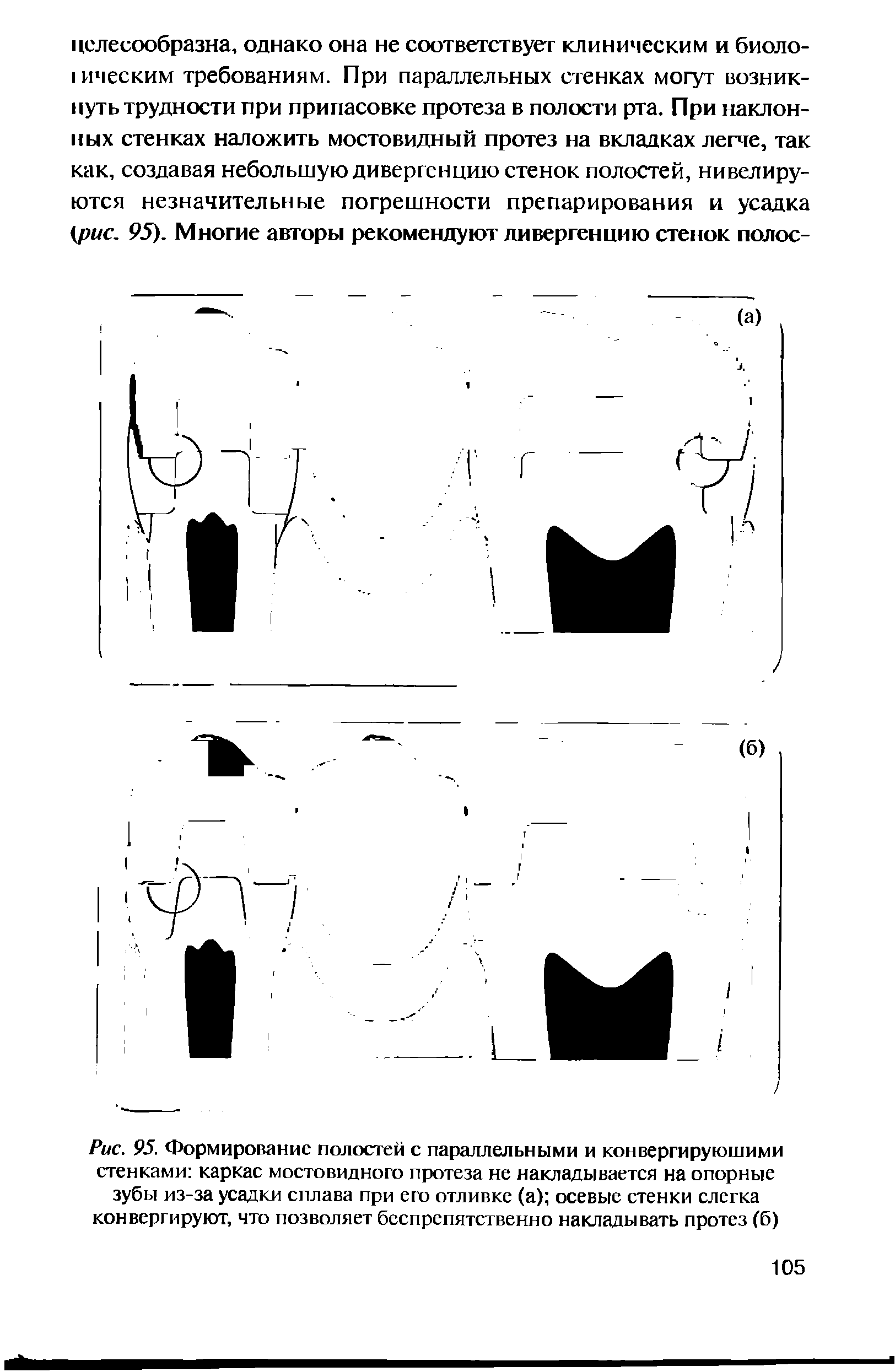 Рис. 95. Формирование полостей с параллельными и конвергирующими стенками каркас мостовидного протеза не накладывается на опорные зубы из-за усадки сплава при его отливке (а) осевые стенки слегка конвергируют, что позволяет беспрепятственно накладывать протез (б)...